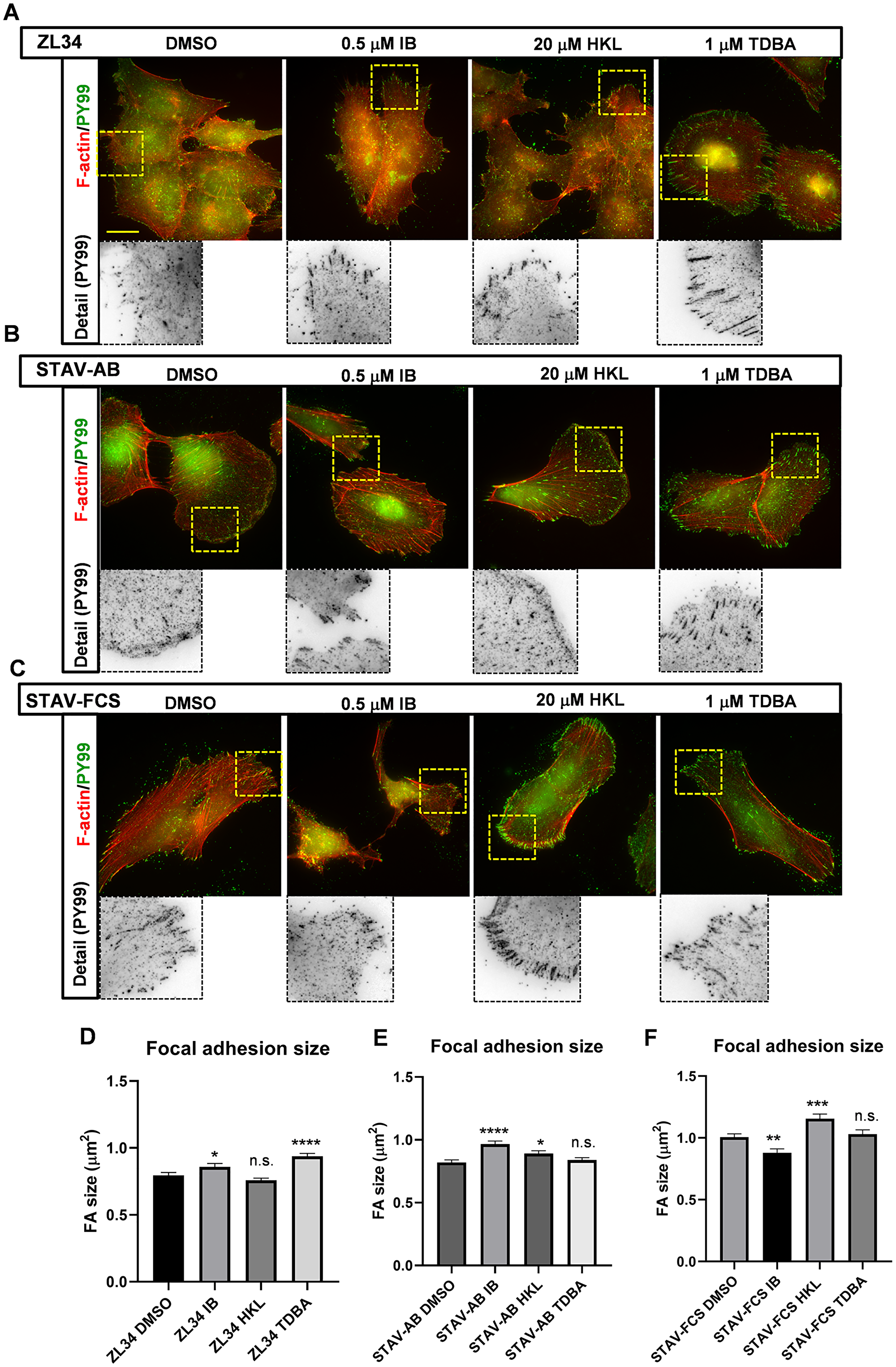 Effects of the inhibitors on organization of focal adhesions and focal contacts