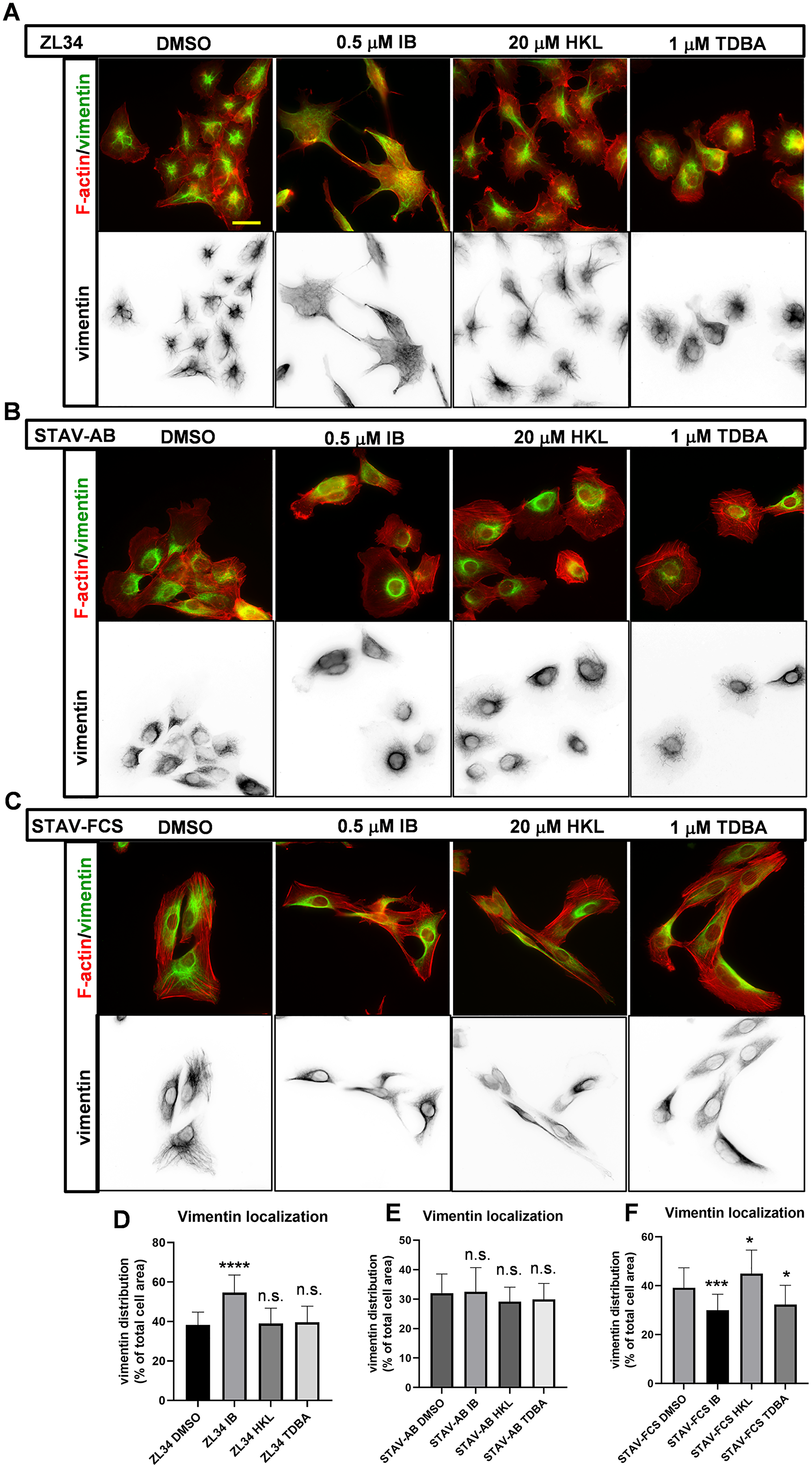 Effects of the inhibitors on the organization of vimentin filaments