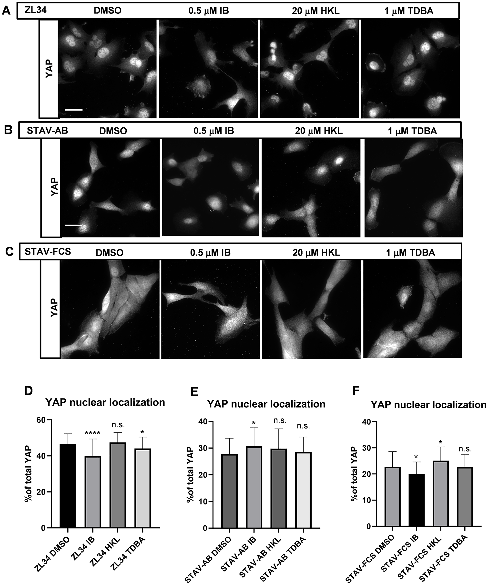 Effects of the inhibitors on the YAP nuclear localization