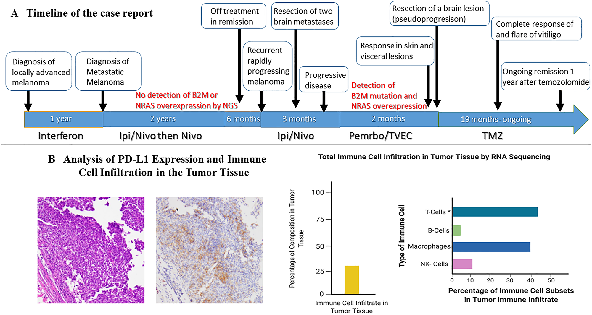 Timeline of the case and changes in lymphocyte count during treatment with temozolomide