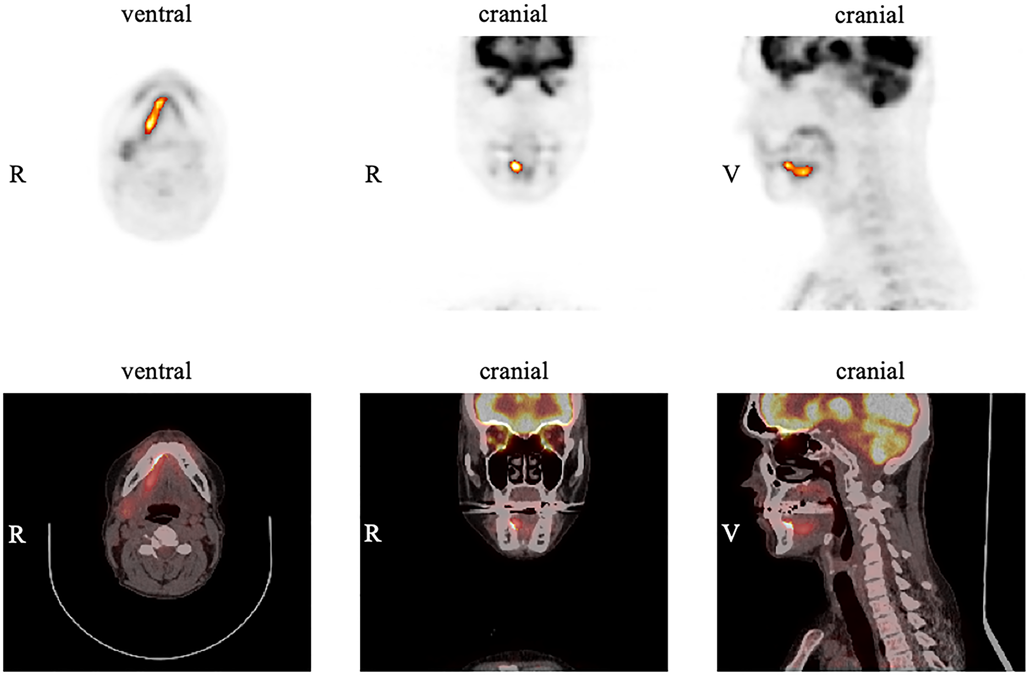 Example of measurements in FDG PET for the primary tumor using the software ROVER