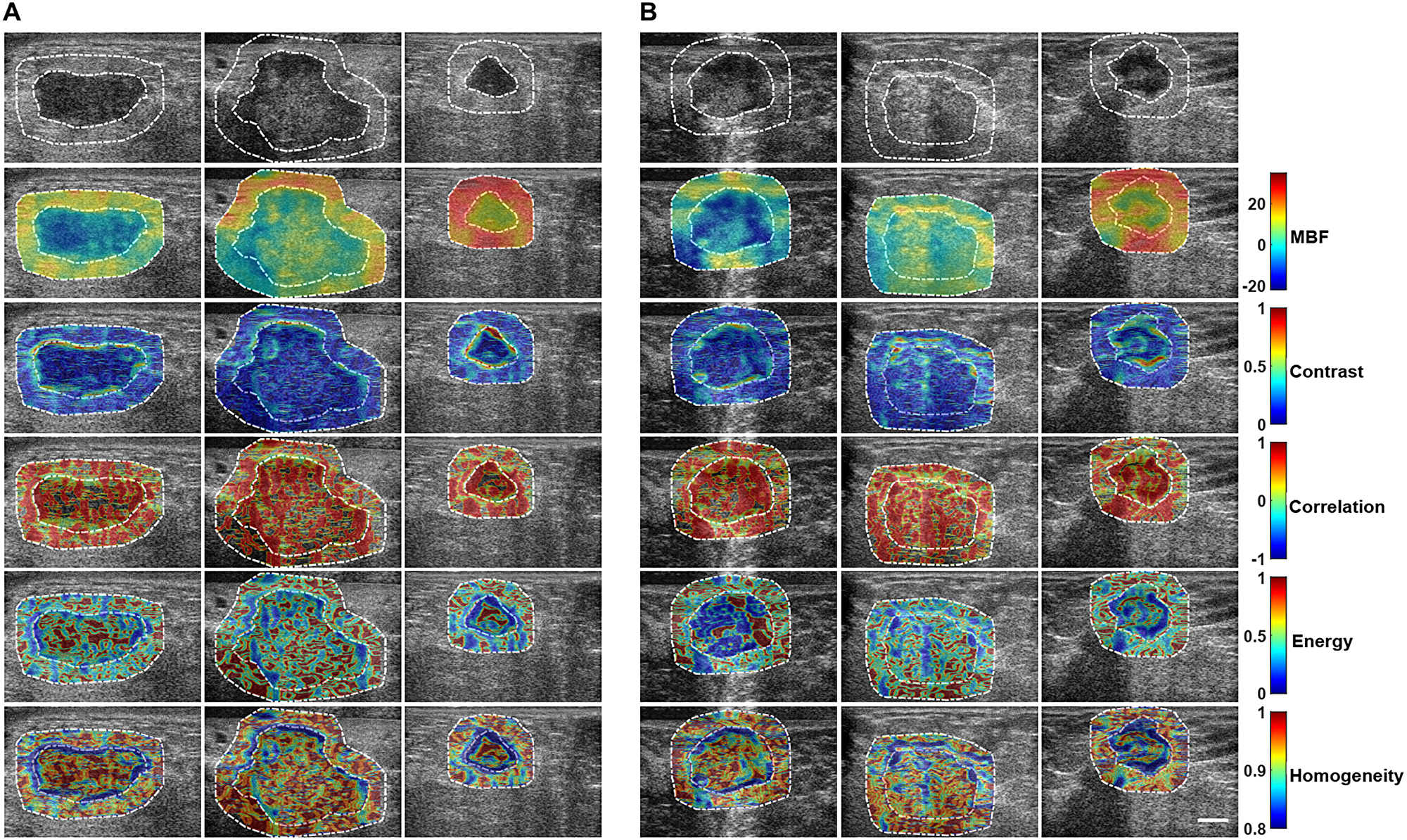 Texture maps for the two response groups