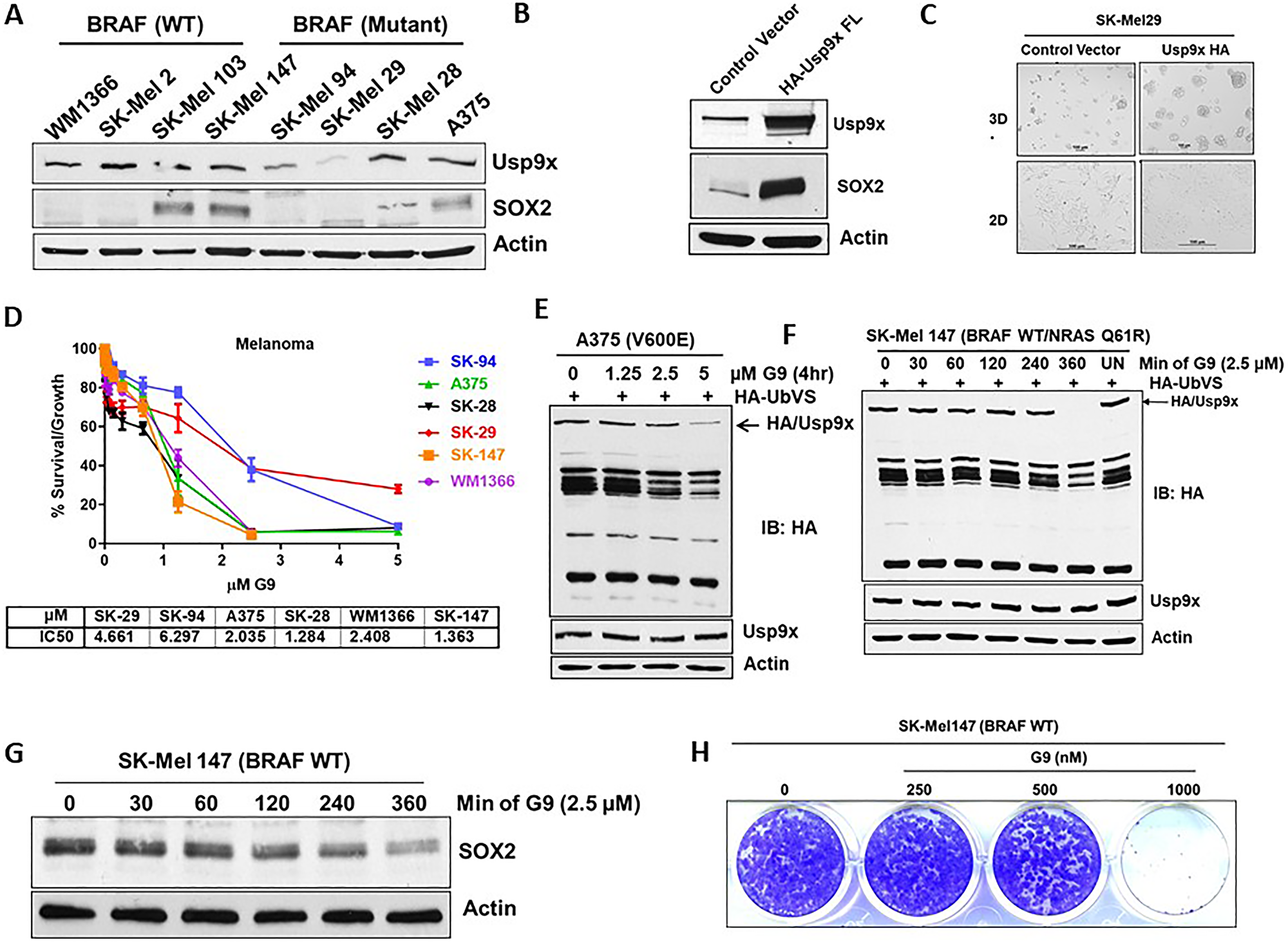 Melanoma cells that express Usp9x and SOX2 are vulnerable to G9