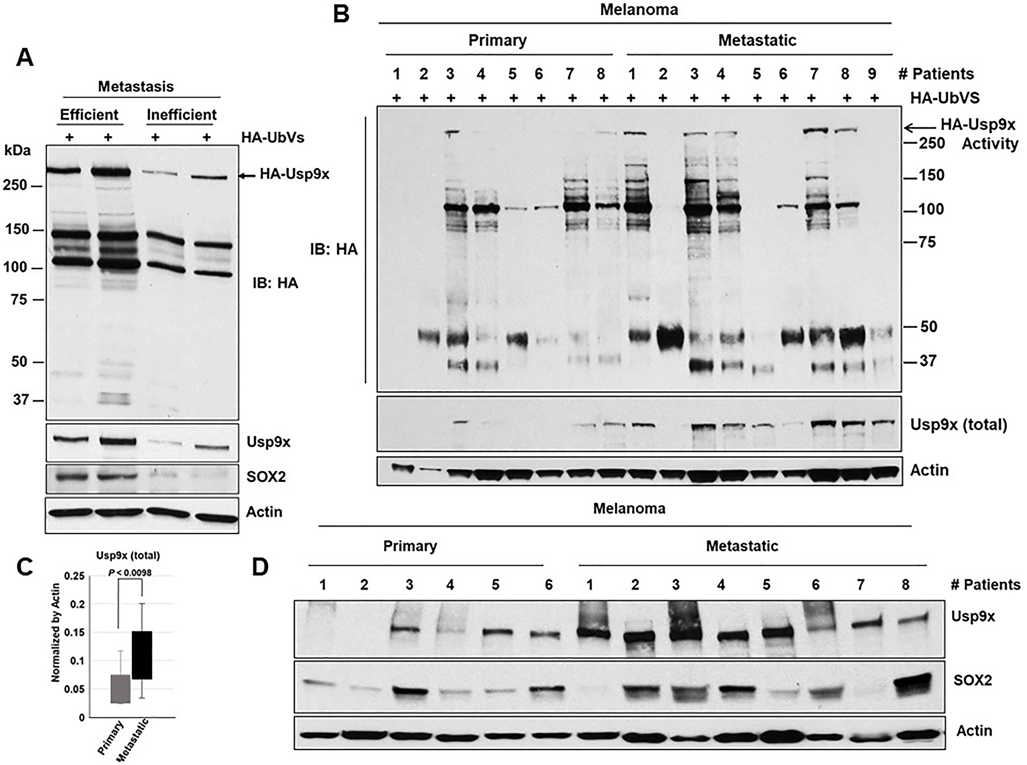 Usp9x and SOX2 are co-expressed in metastatic melanoma