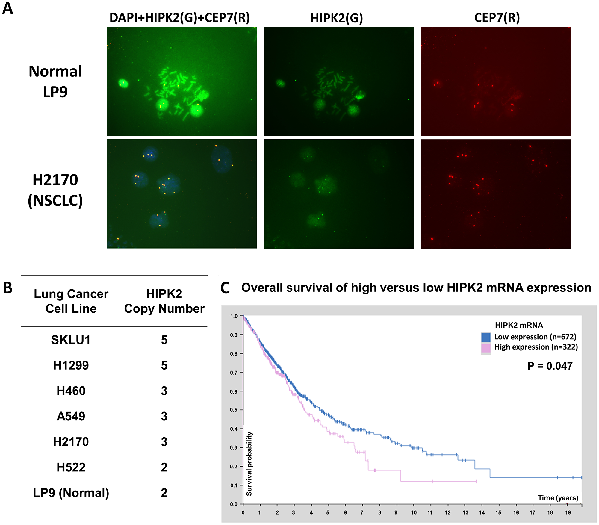 HIPK2 FISH analysis in NSCLC cell lines and HIPK2 overexpression correlates with poor survival of NSCLC patients