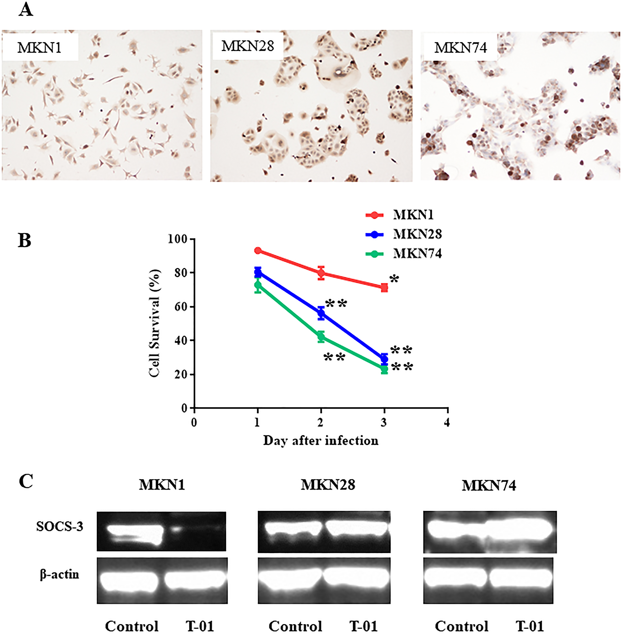 SOCS3 expression in human gastric cancer cell line after oncolytic virus infection