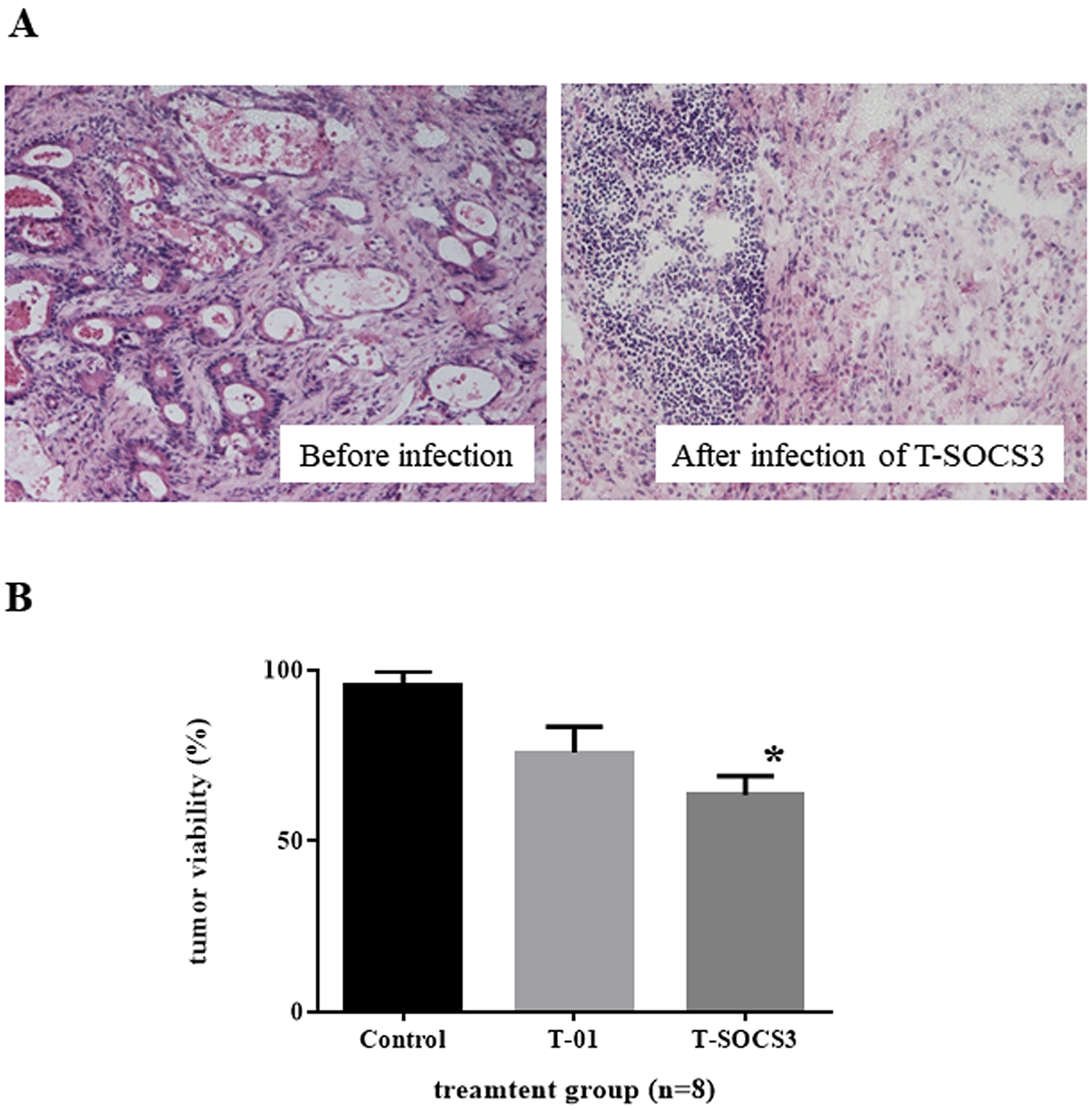 Ex vivo assessment of oncolytic herpes simplex virus killing effect in gastric cancer