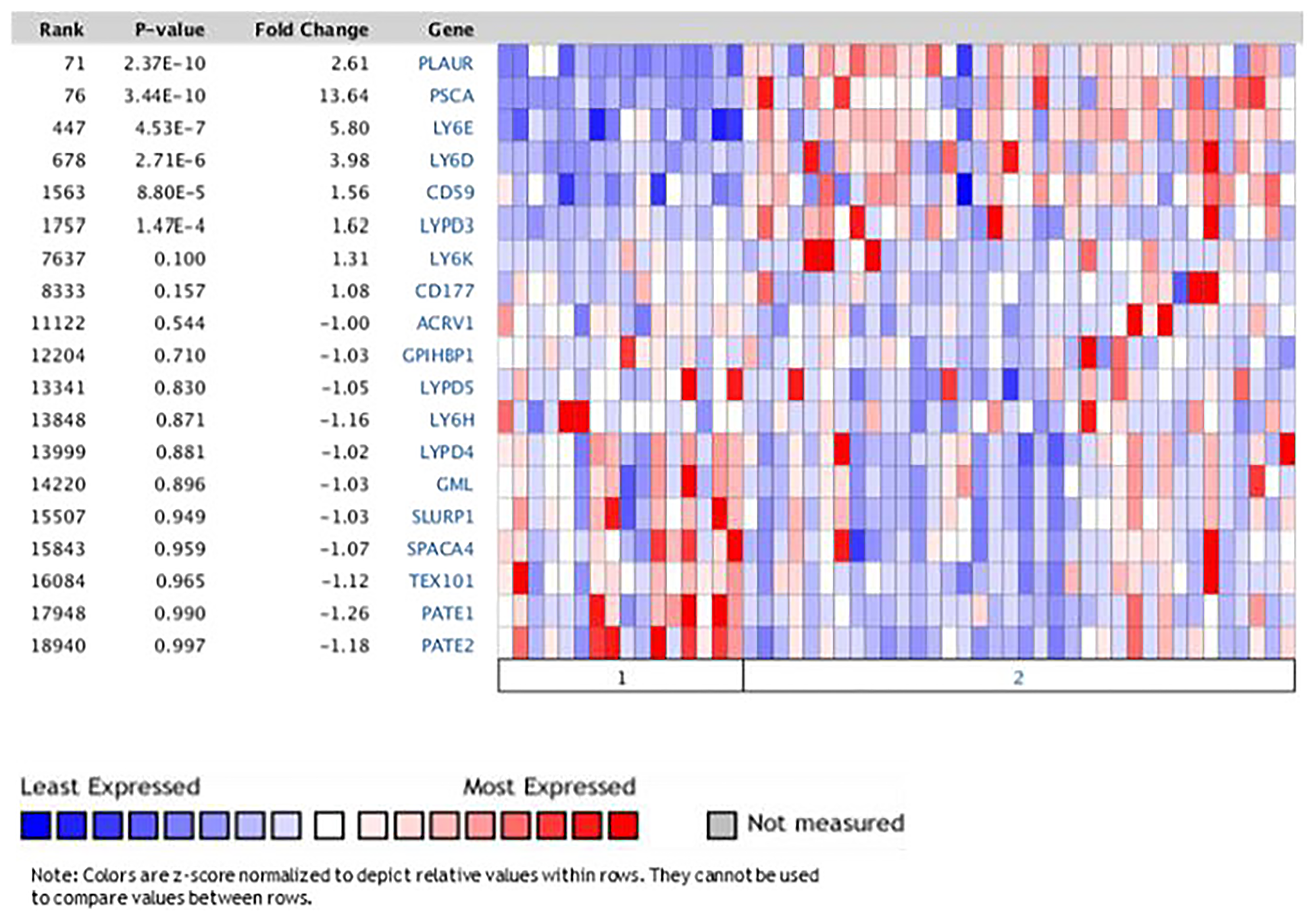 Oncomine tool showed significant increase expression of LY6 genes in pancreatic tumor vs normal tissues in Pei dataset comparing normal vs tumor PDAC tissue