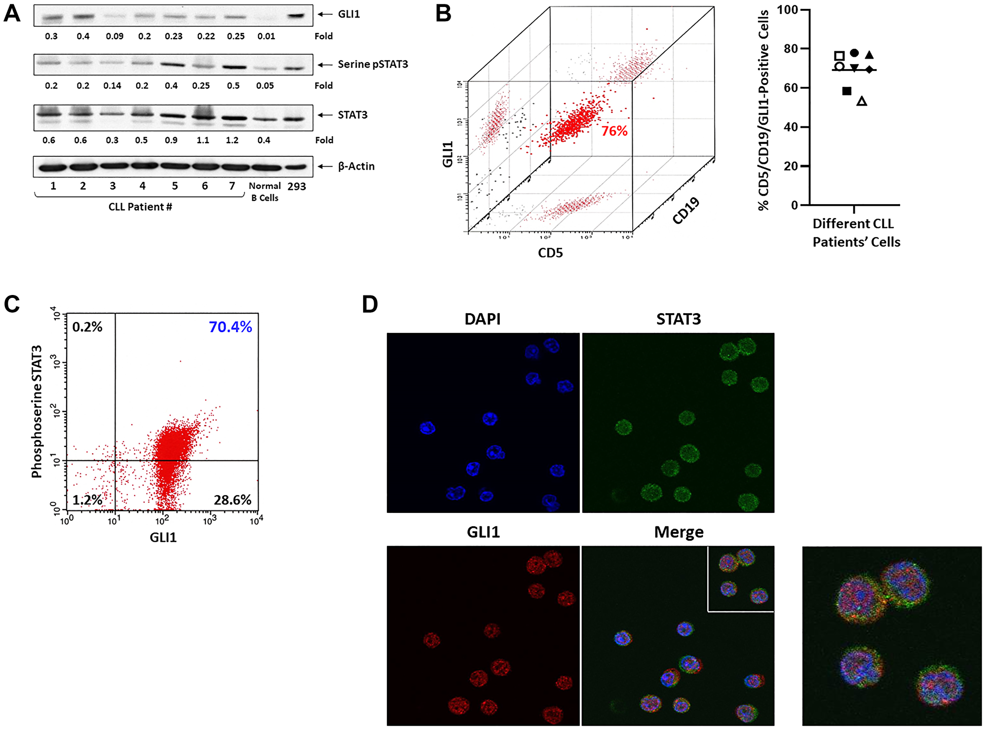 GLI1 protein detected in CLL cells but not in normal B cells