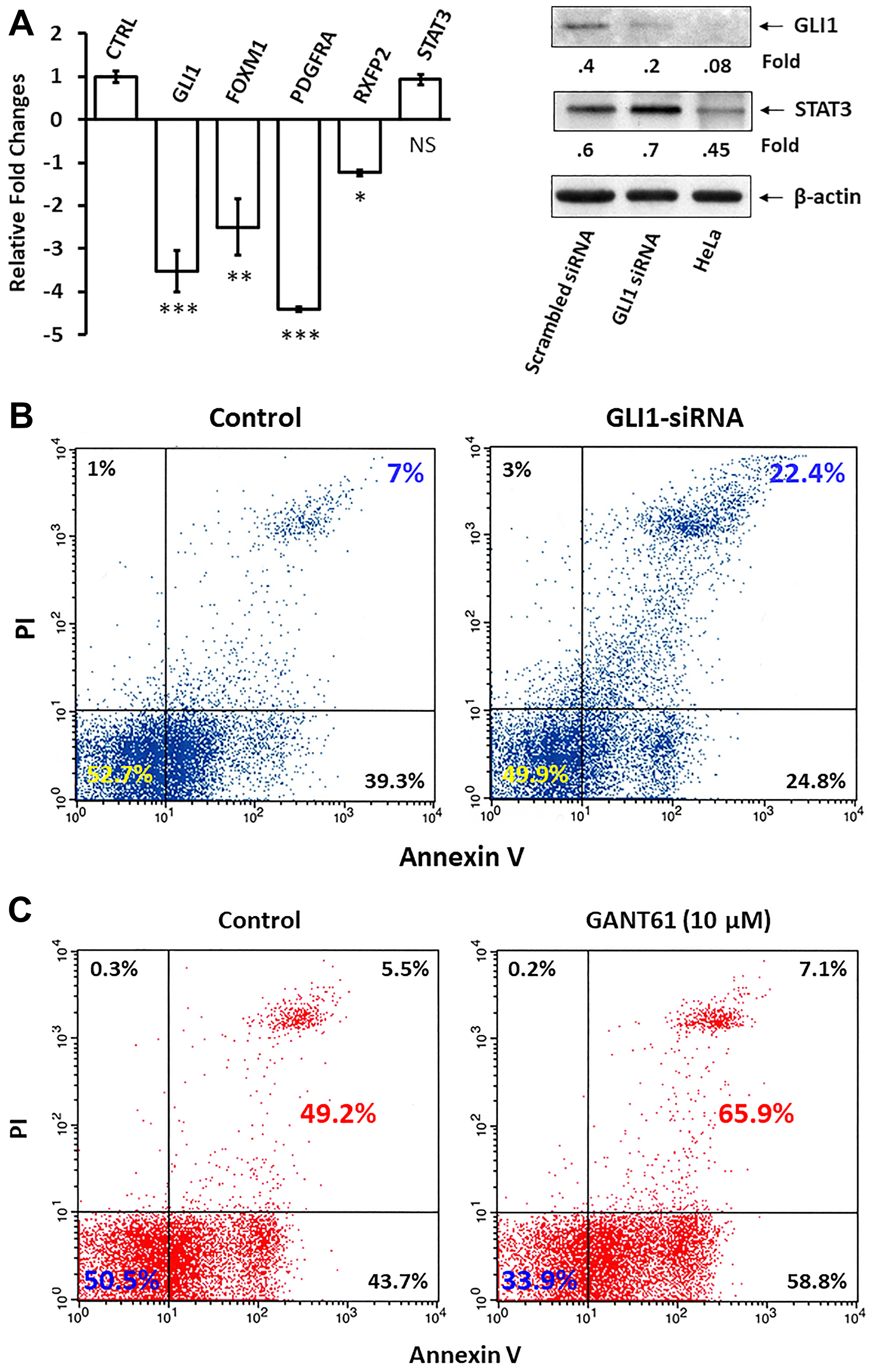 GLI1 protects CLL cells from apoptosis