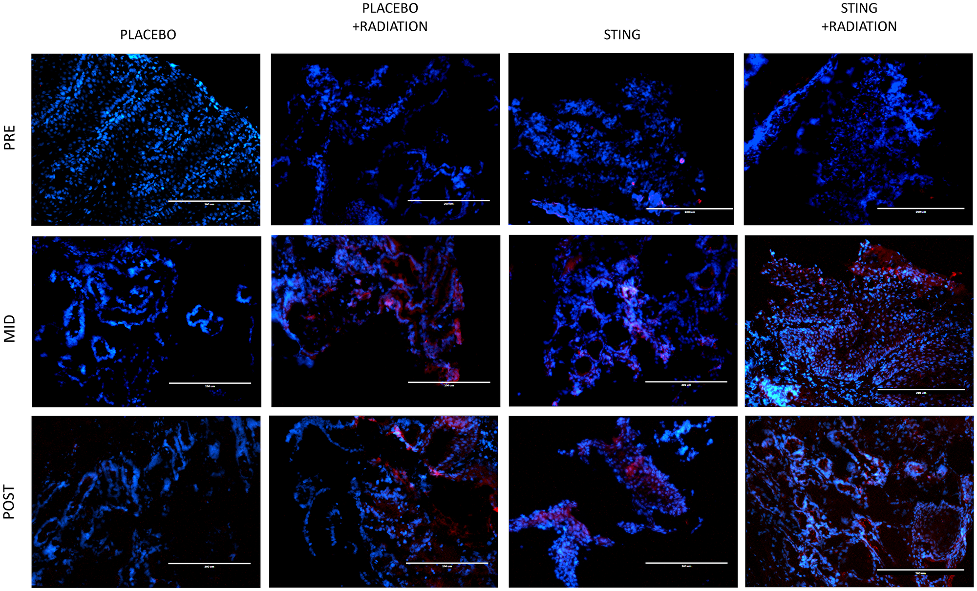 PD-L1 immunofluorescence, by treatment group