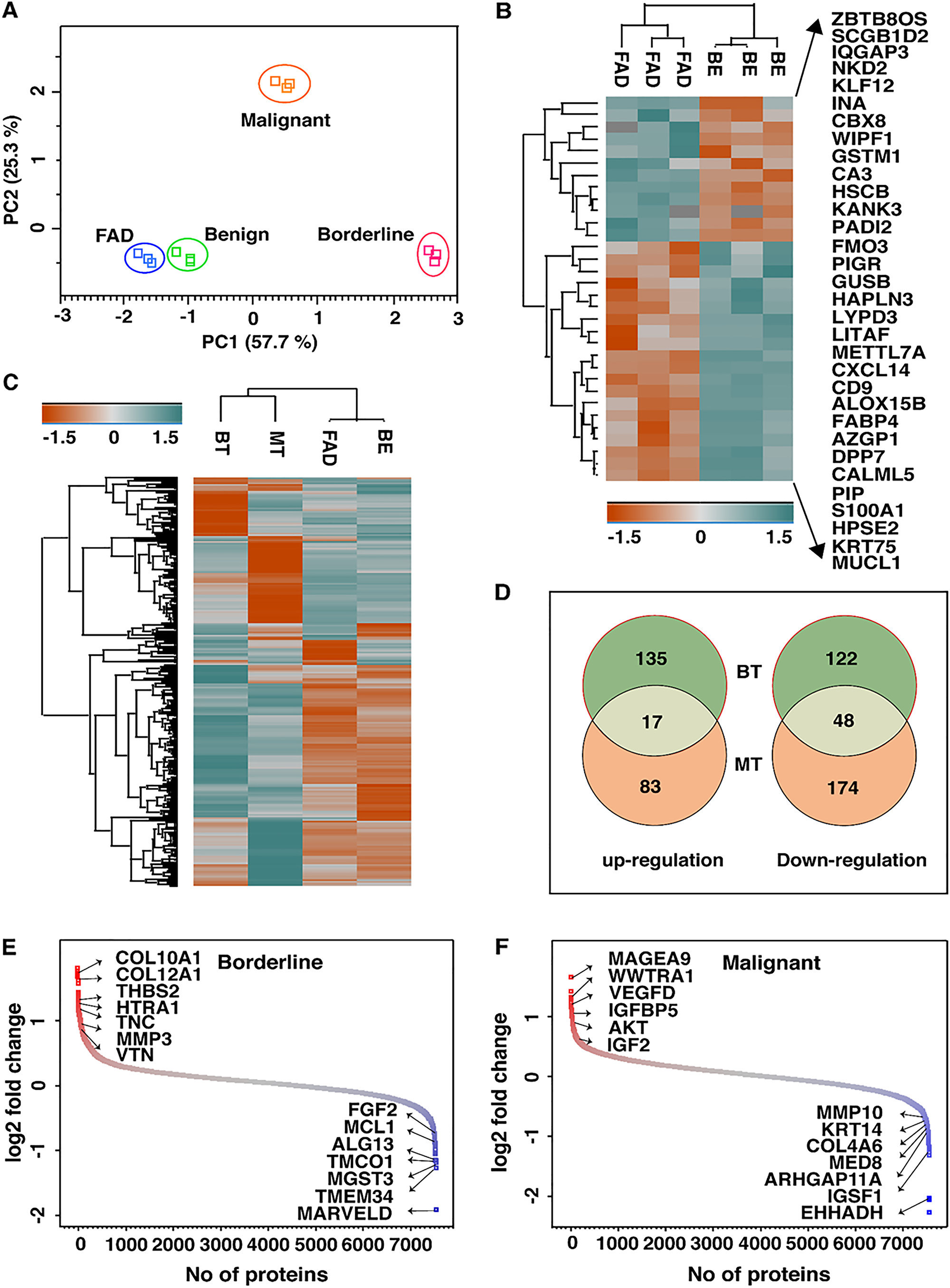 (A) Principle component analysis of quantified proteins reveals distinct separation of FELs subtypes where BE and FAD clustered together being mostly as indolent tumors. (B) List of proteins that are significantly dysregulated in FAD as compared to BE PTs. (C) Heatmap of dysregulated proteins (1.5 folds) in FAD, BT and MT as compared to BE PTs. (D) Venn diagram showing unique and common dysregulated proteins in BT and MT PTs. Distribution of log 2- fold changes of total proteins in (E) BT vs BE and (F) MT vs BE; red and blue dots represents up and down regulated proteins by 1.5 folds respectively.