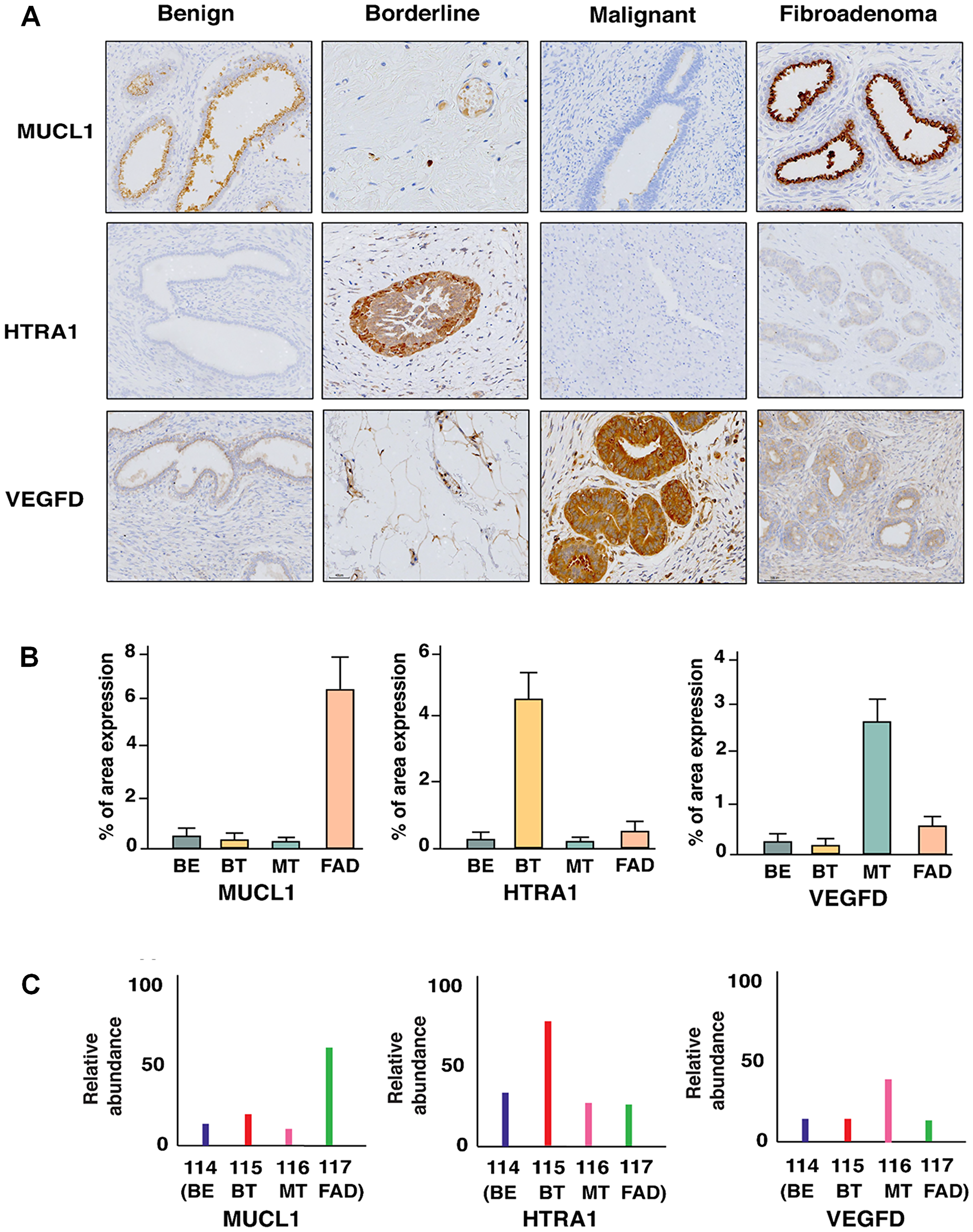 (A) Immunohistochemical staining of MUCL1, HTRA1, and VEGFD which are uniquely overexpressed in FAD, BT, and MT respectively. (B) Percentage of area expression and (C) relative abundance of MUCL1, HTRA1, and VEGFD in FAD, BT, and MT respectively.