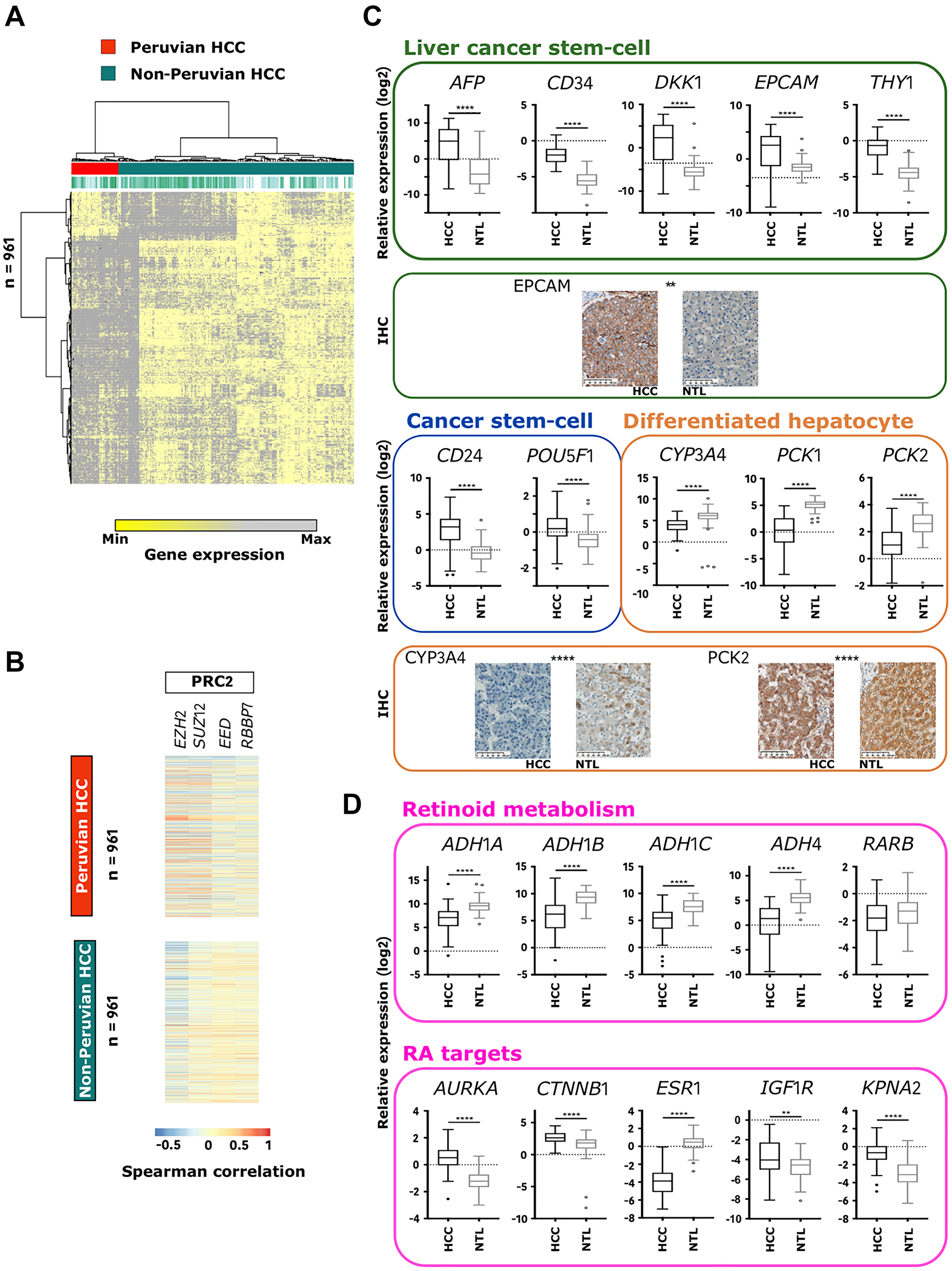 Amerind signature identifies Peruvian HCC as a distinct phenotypic cluster