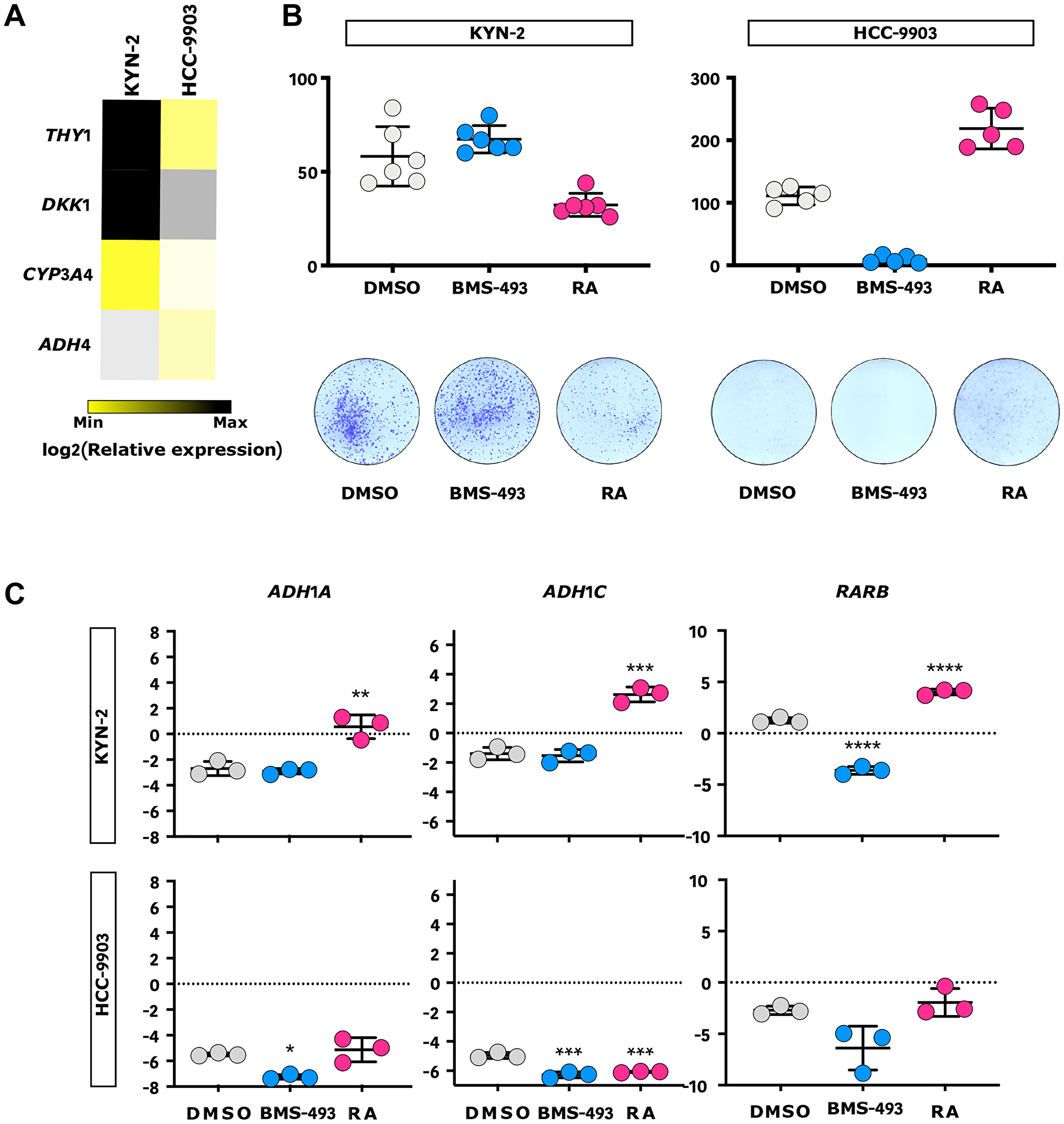 RA inhibits progenitor-like liver cancer cell growth in vitro
