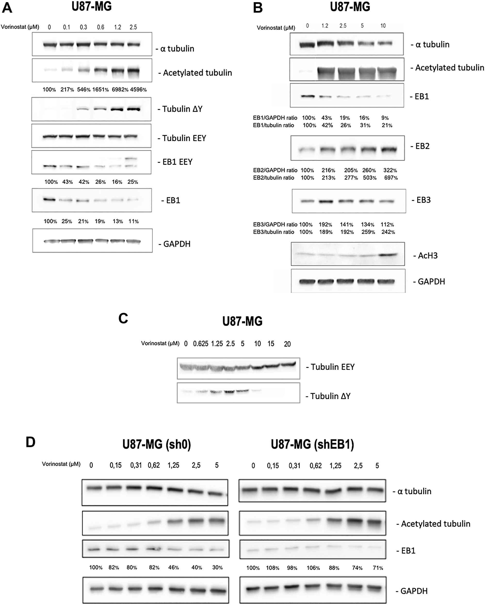 Vorinostat acts on microtubular system in an independent histone manner in U87-MG, U87-MG sh0 and U87-MG shEB1 glioblastoma cells