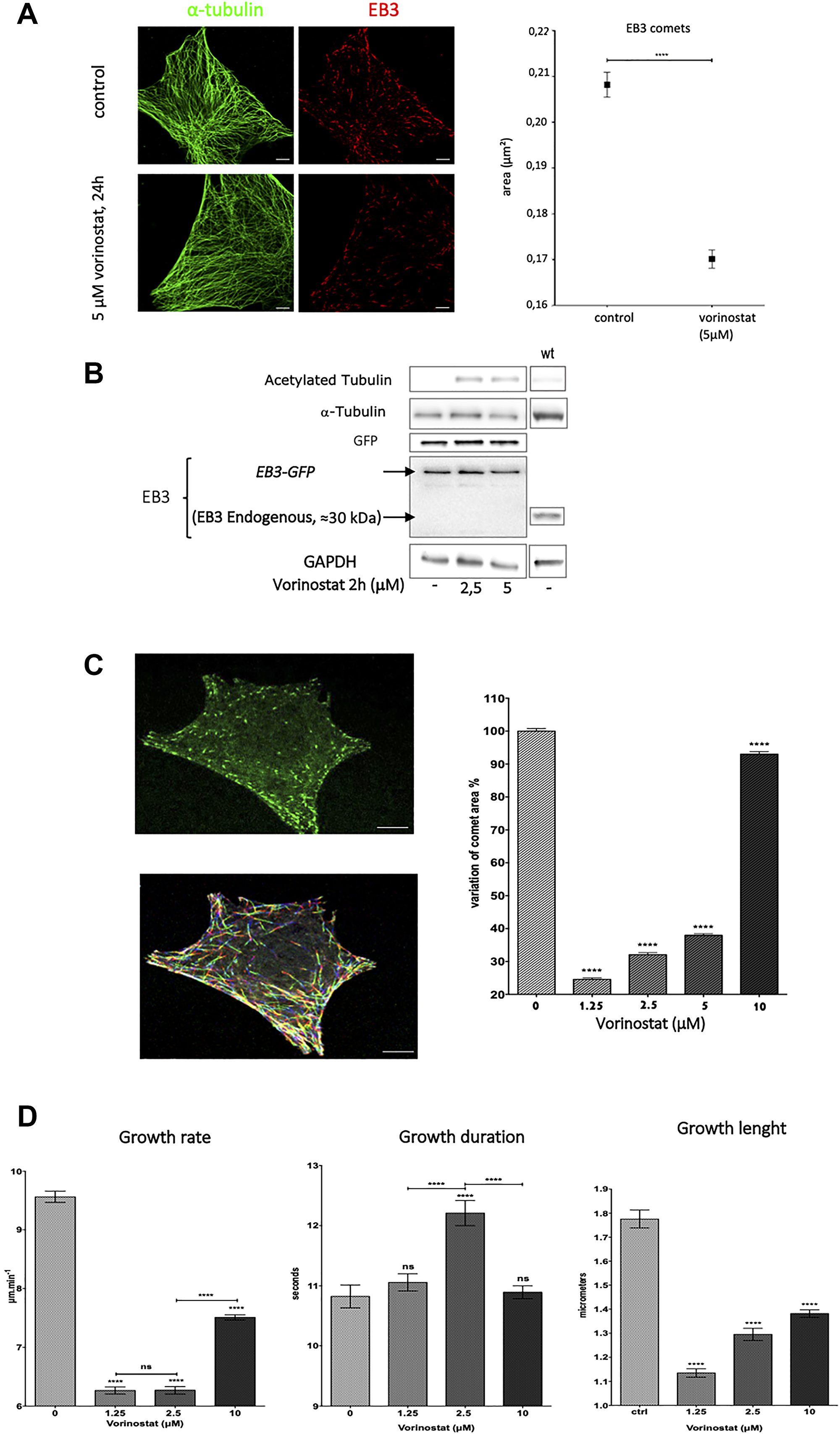 Vorinostat deacreases EB3 comets area and suppress microtubule dynamics in U87-MG glioblastoma cells