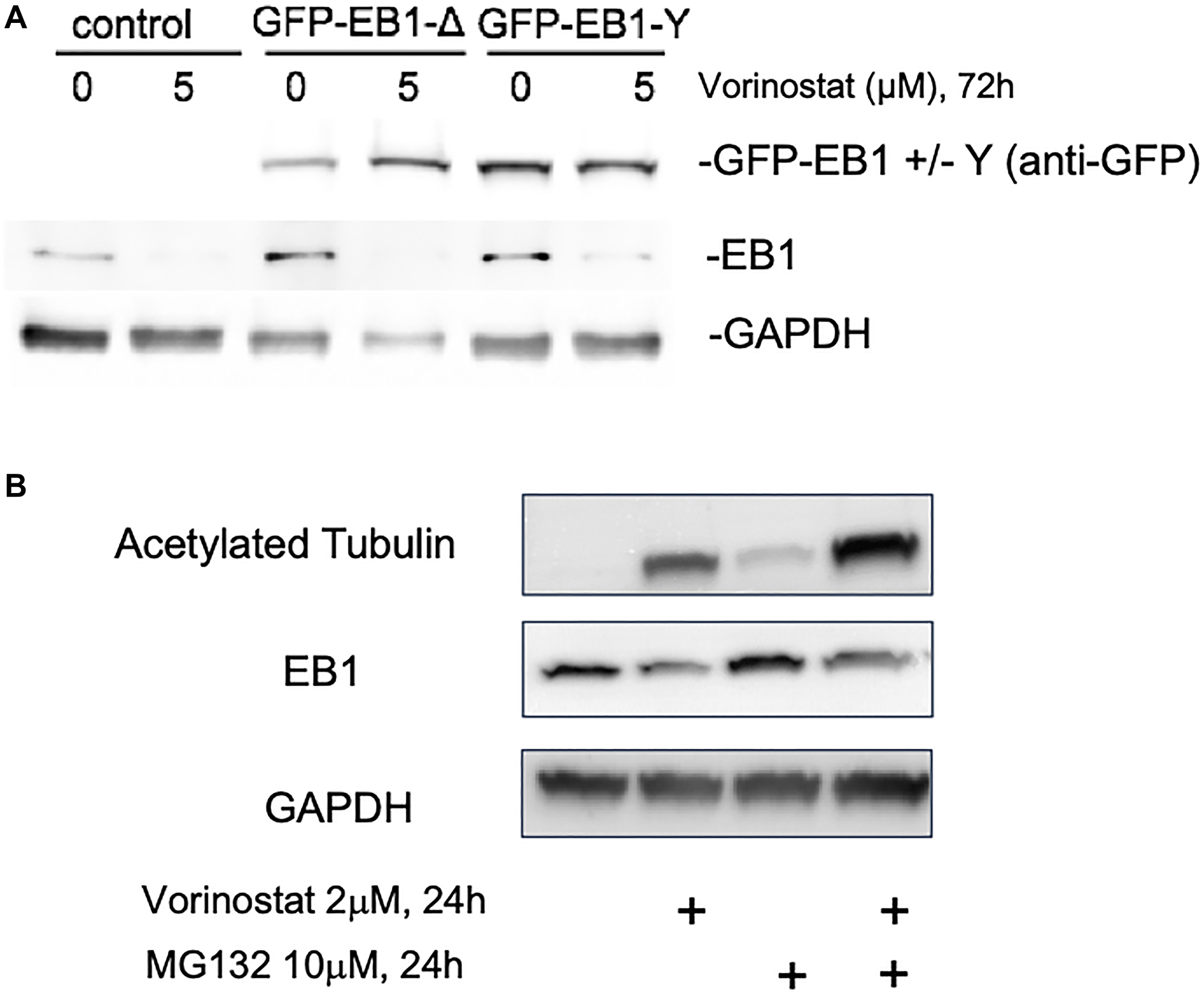 Vorinostat changes U87-MG endogenous EB1 expression but not GFP-EB1