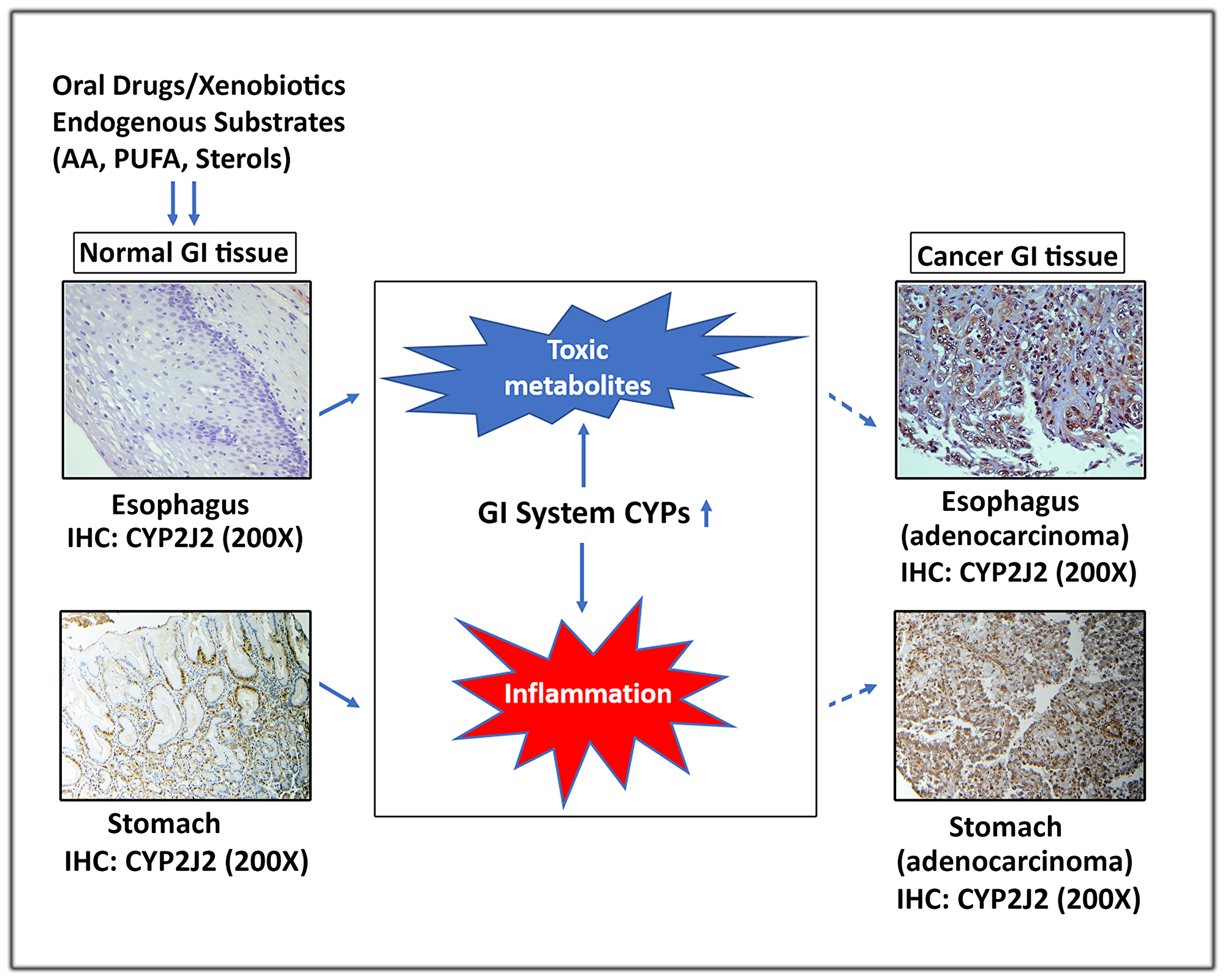 A schematic representation depicting the role of extrahepatic GI system CYPs in carcinogenesis