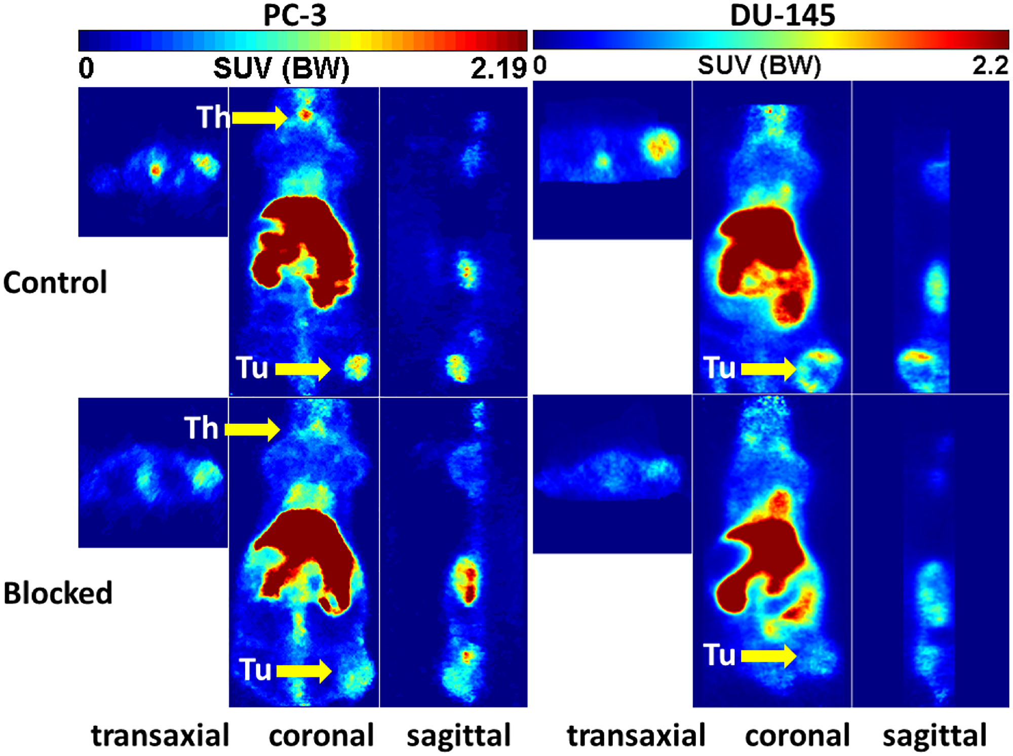 Representative orthogonal sections of PET studies