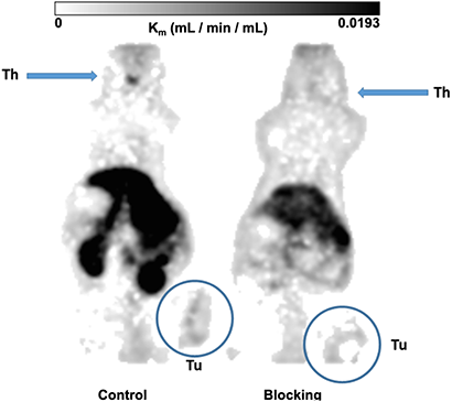 Metabolic trapping rate (Patlak Km) images