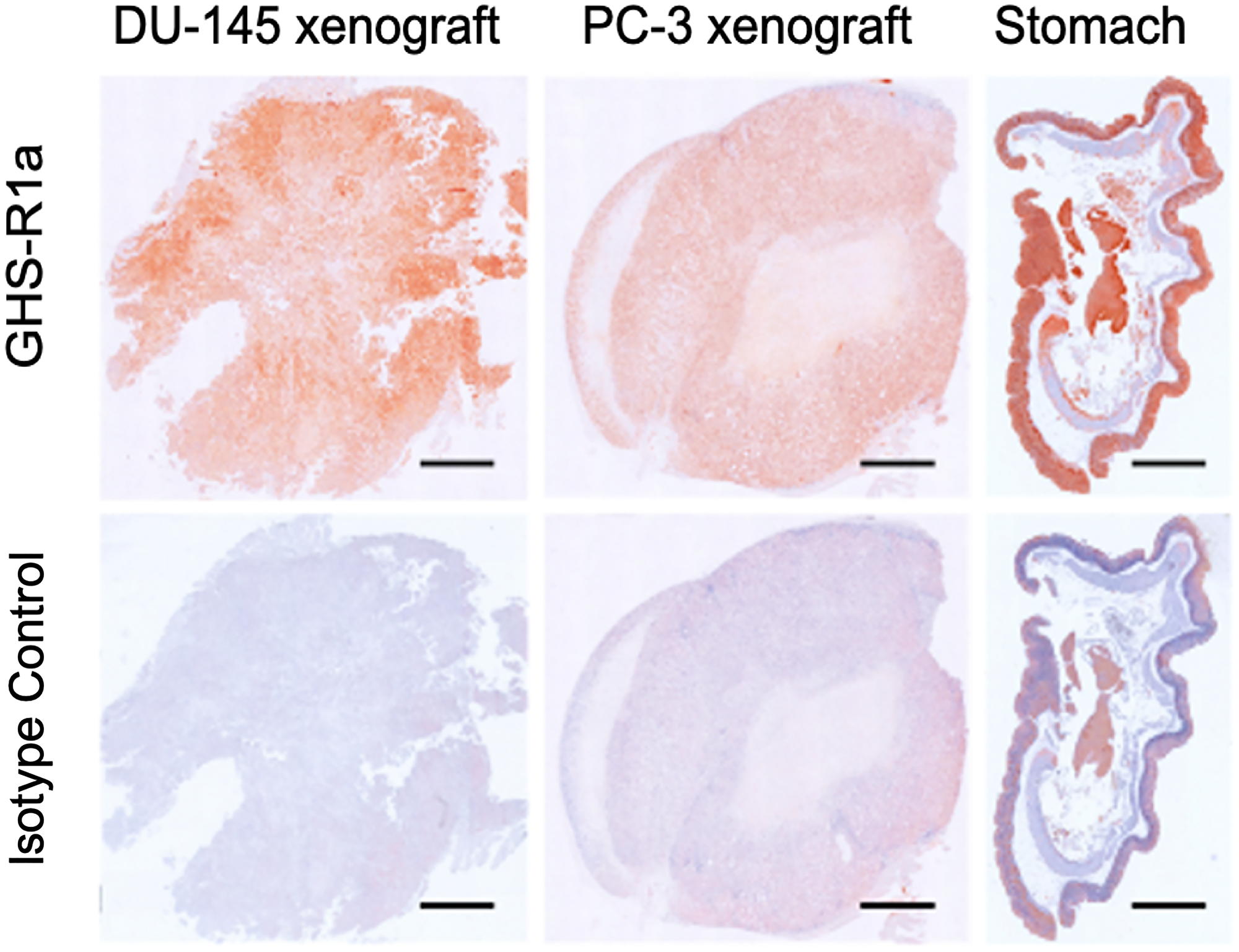 Immunohistochemistry of GHS-R1a