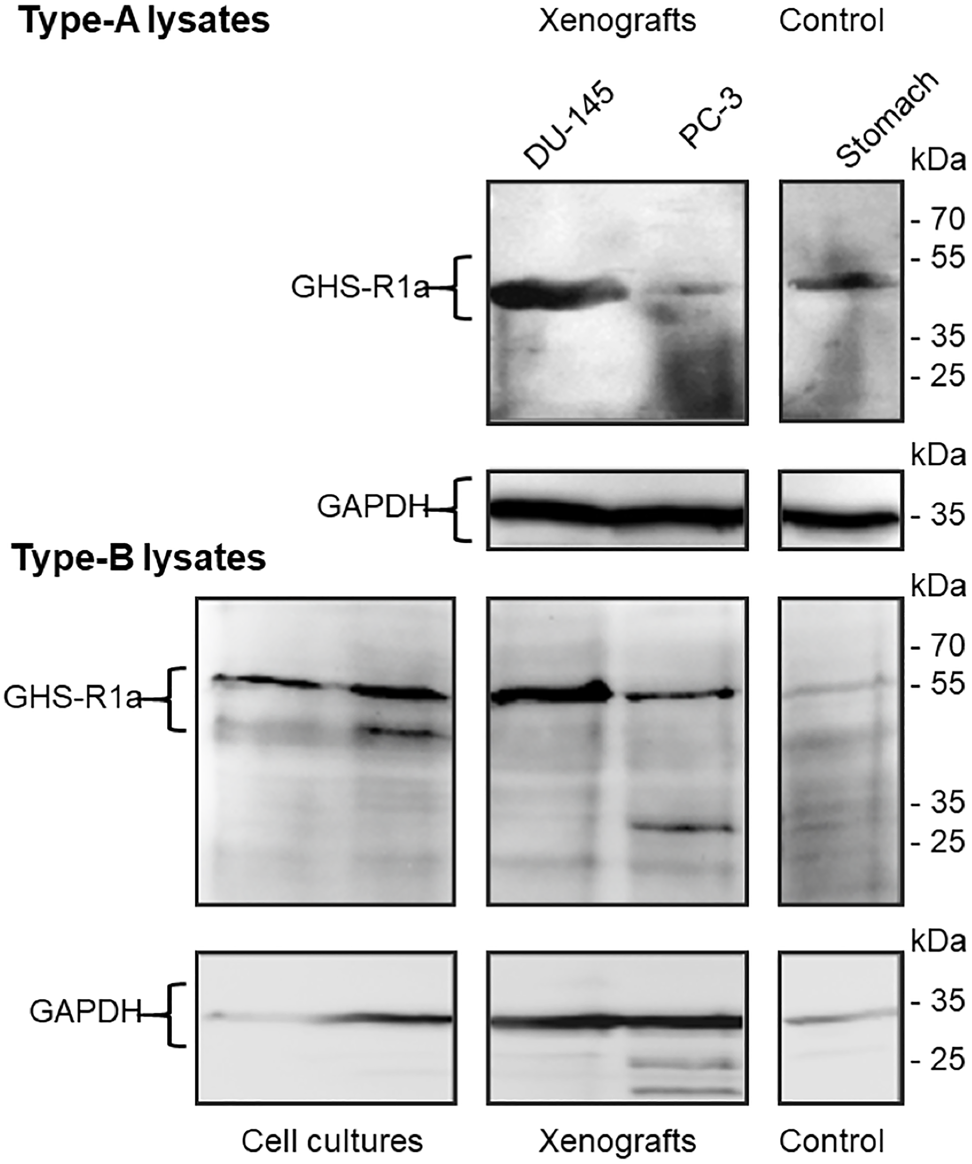 Immunoblots of GHS-R1a in lysates of DU-145 and PC-3 cell cultures, xenografts and Control