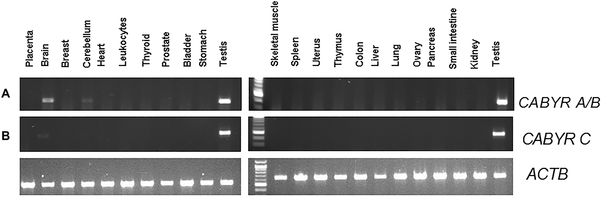 (A) Semi-quantitative analysis of CABYR a/b expression in pooled RNA various different normal human tissues (testis, placenta, bladder, brain, breast, cerebellum, colon, small intestine, heart, kidney, leukocytes, liver, lung, skeletal muscle, ovary, pancreas, prostate, spleen, stomach, thymus, thyroid, uterus). (B) Semi-quantitative analysis of CABYR c expression in pooled RNA various different normal human tissues (testis, placenta, bladder, brain, breast, cerebellum, colon, small intestine, heart, kidney, leukocytes, liver, lung, skeletal muscle, ovary, pancreas, prostate, spleen, stomach, thymus, thyroid, uterus). ATCB band in each lane was human β-actin (ACTB) amplified as control for each tissue types.
