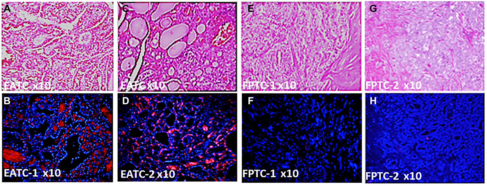Differential expression of DBP protein in Filipino Americans vs. European Americans