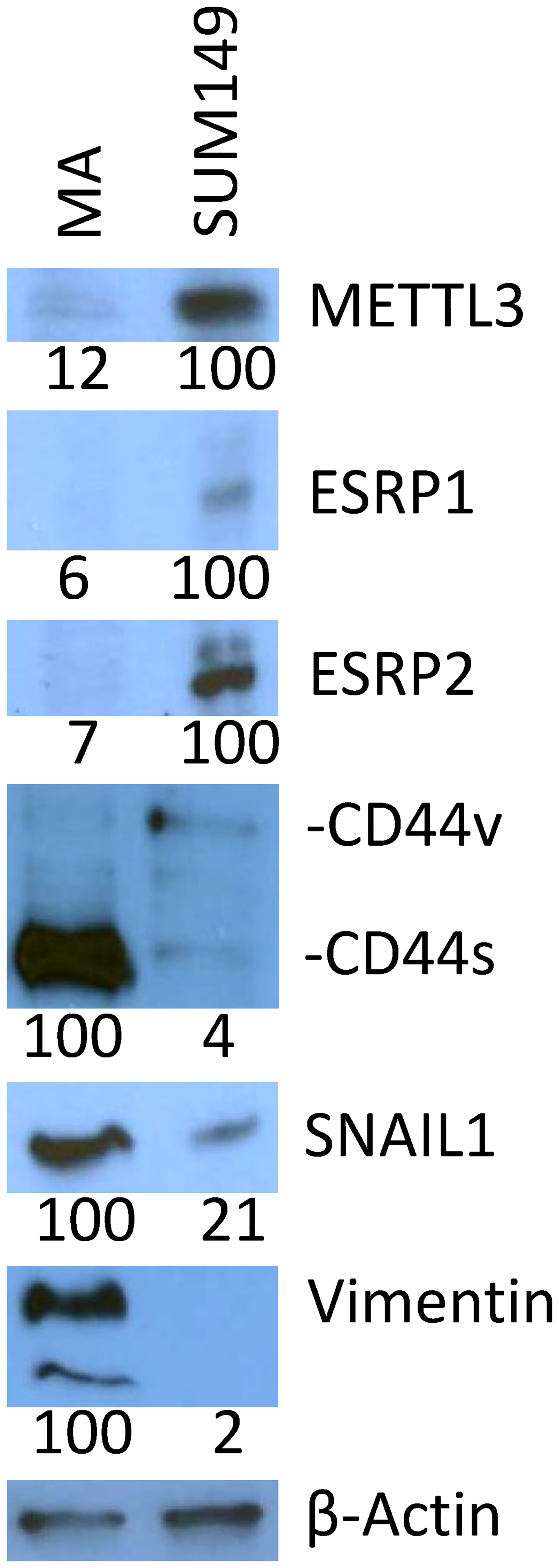 Validation of selected gene expression data with Western blotting
