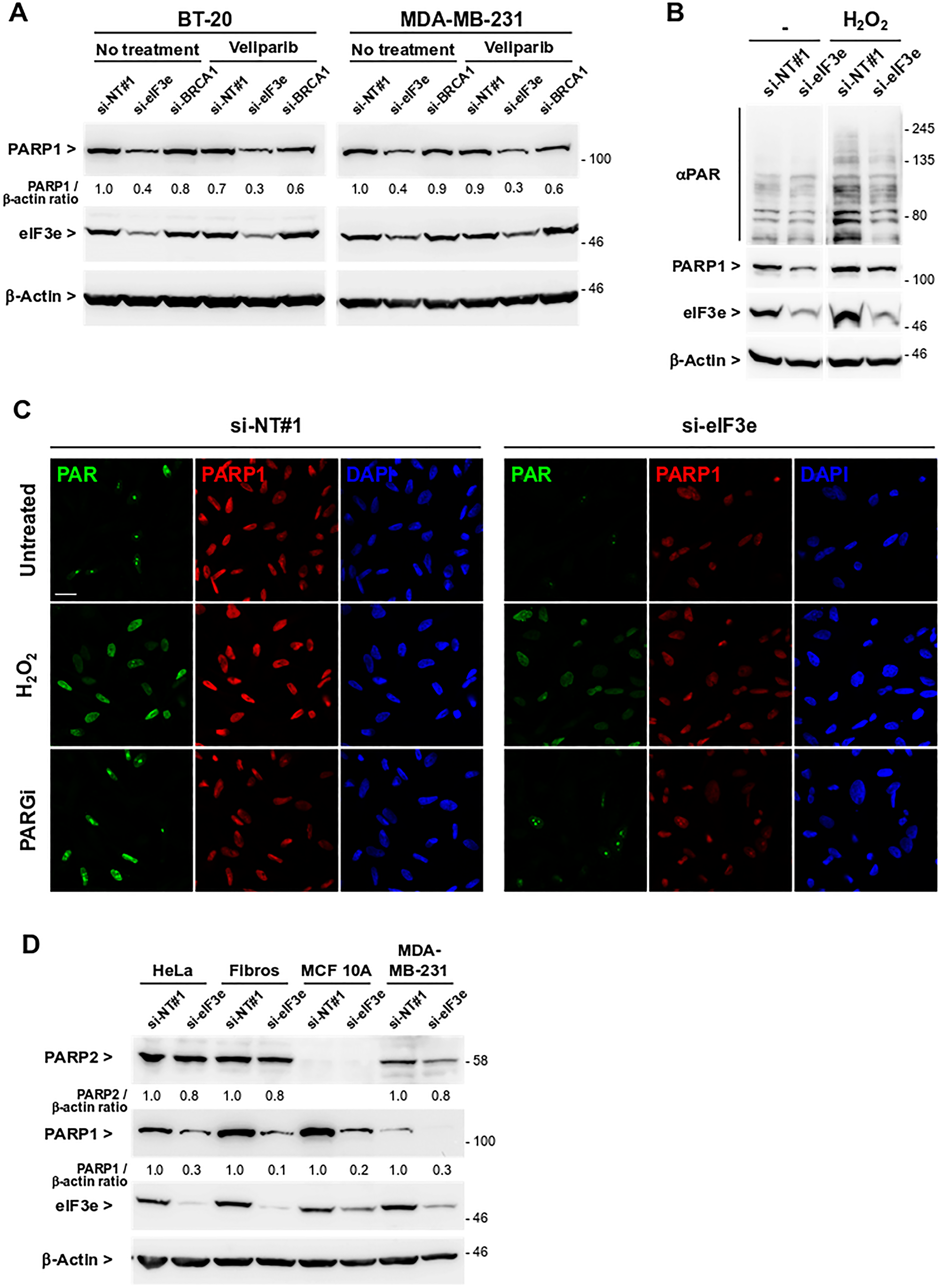 eIF3e depletion leads to lower levels of PARP1 protein and PAR polymers