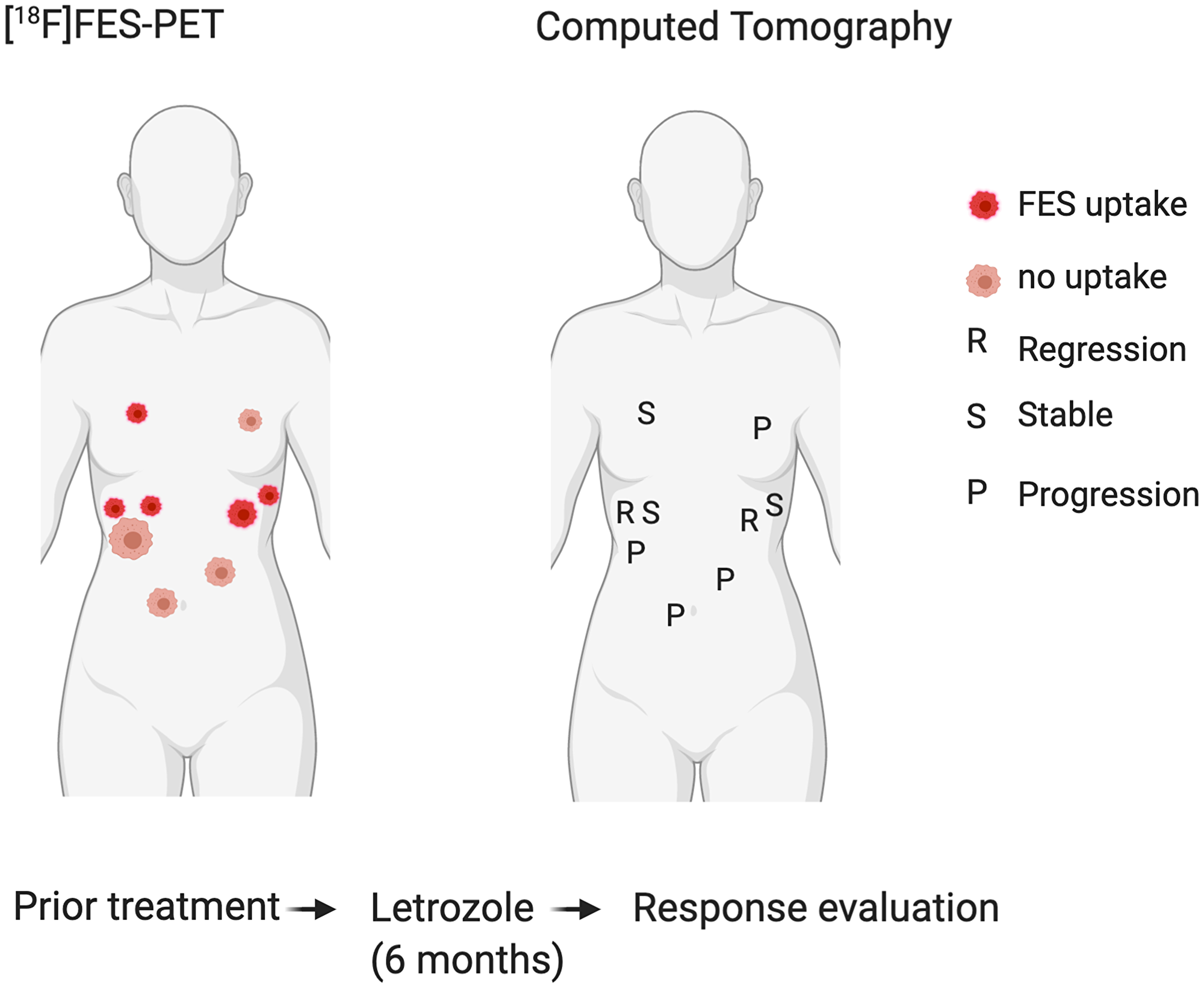 Correlation of FES positive and negative tumour locations (left) with response to hormone treatment (right)
