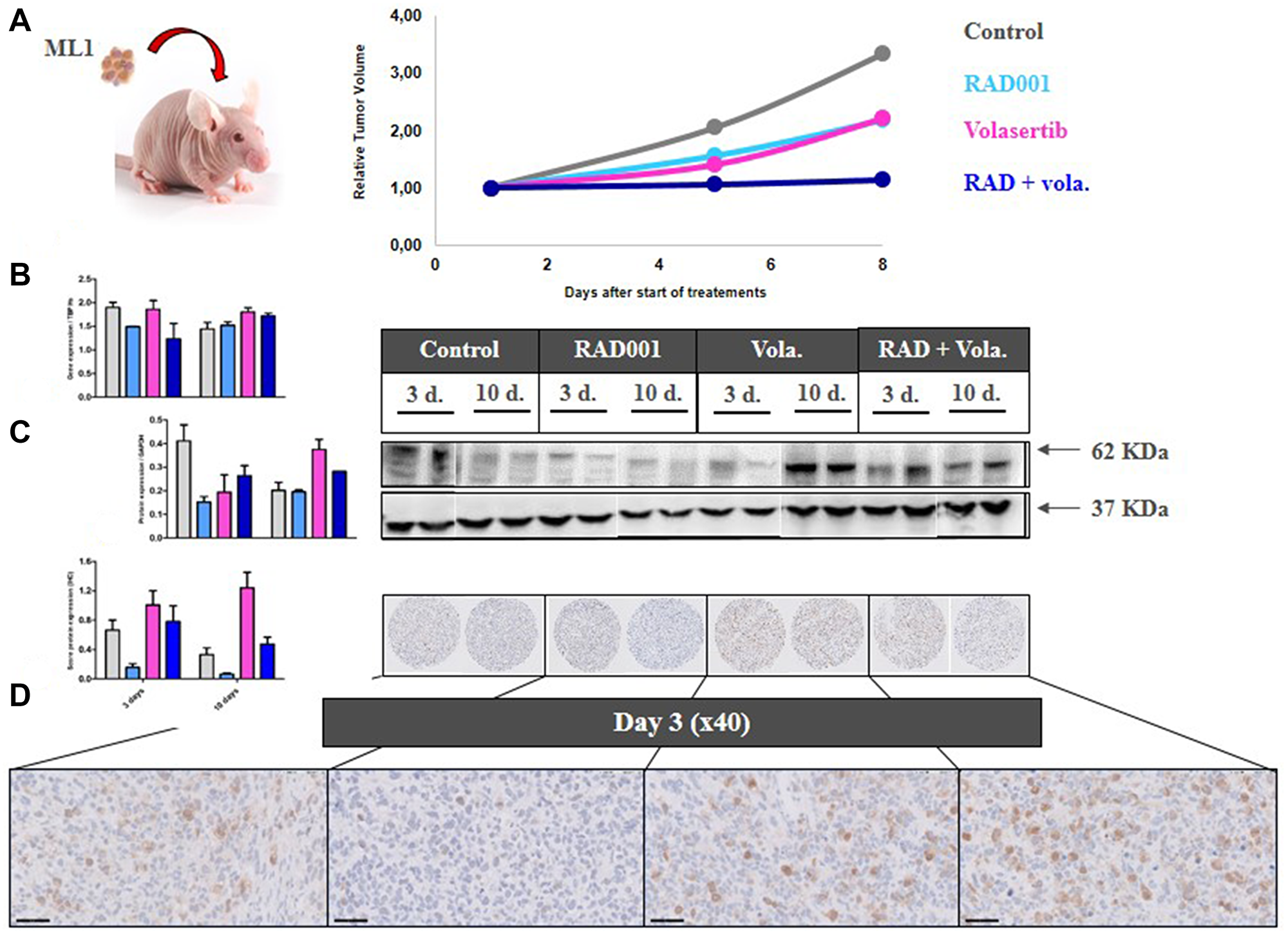 PD study in ML1 PDX and PLK1 expression