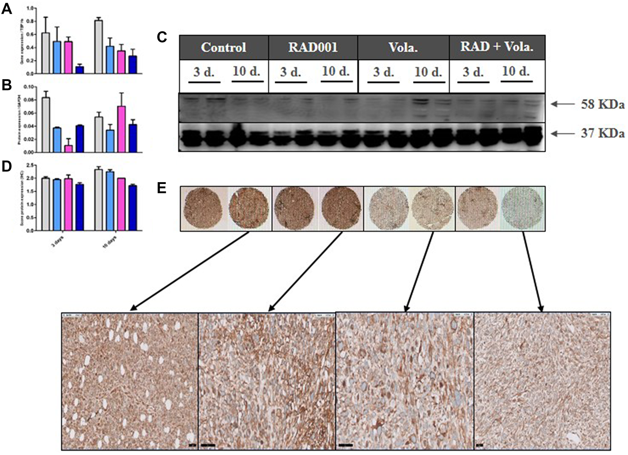 PD study in ML1 PDX and CAIX expression