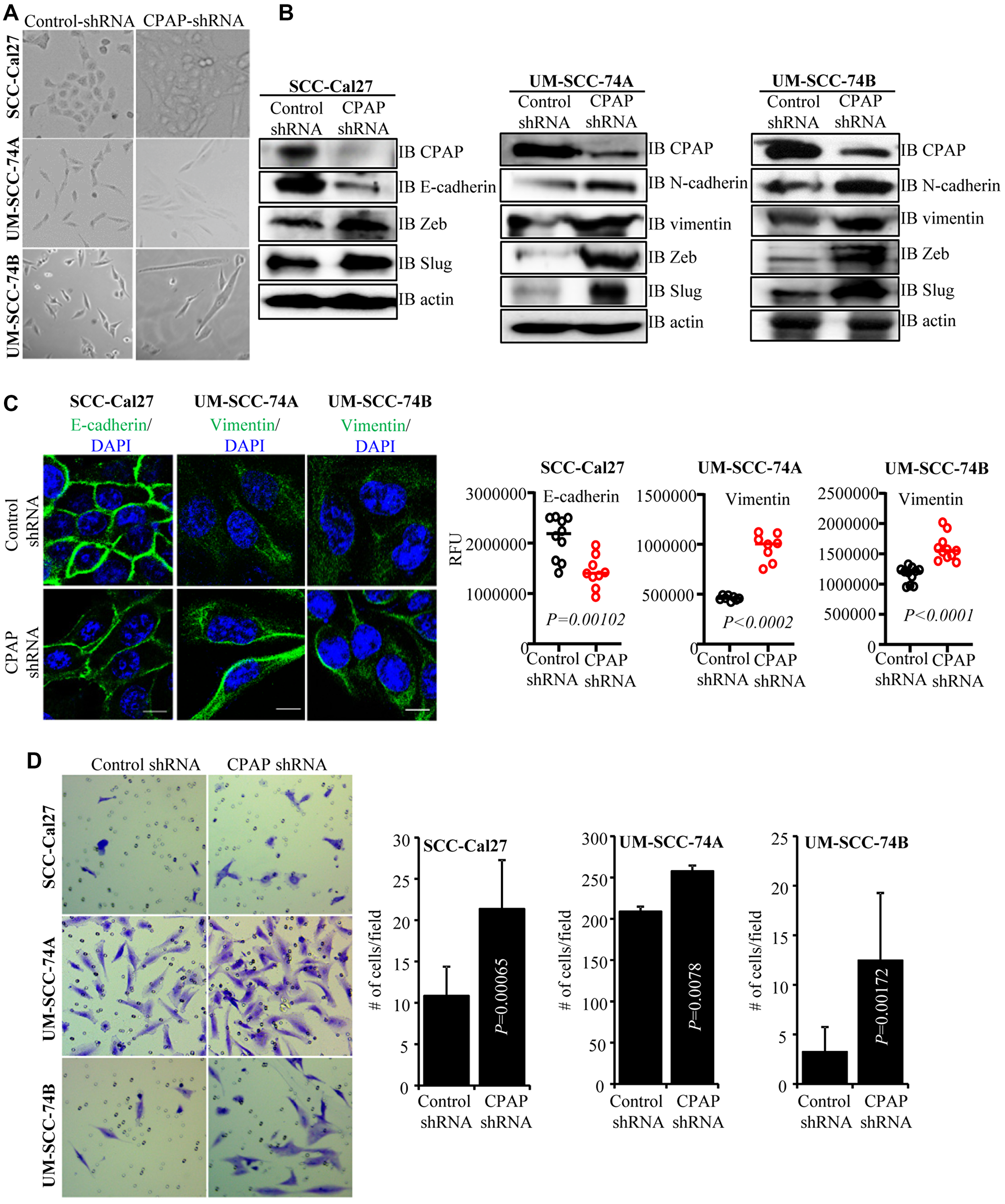 CPAP depleted cells show spontaneous EMT-like morphology and upregulated mesenchymal protein expression