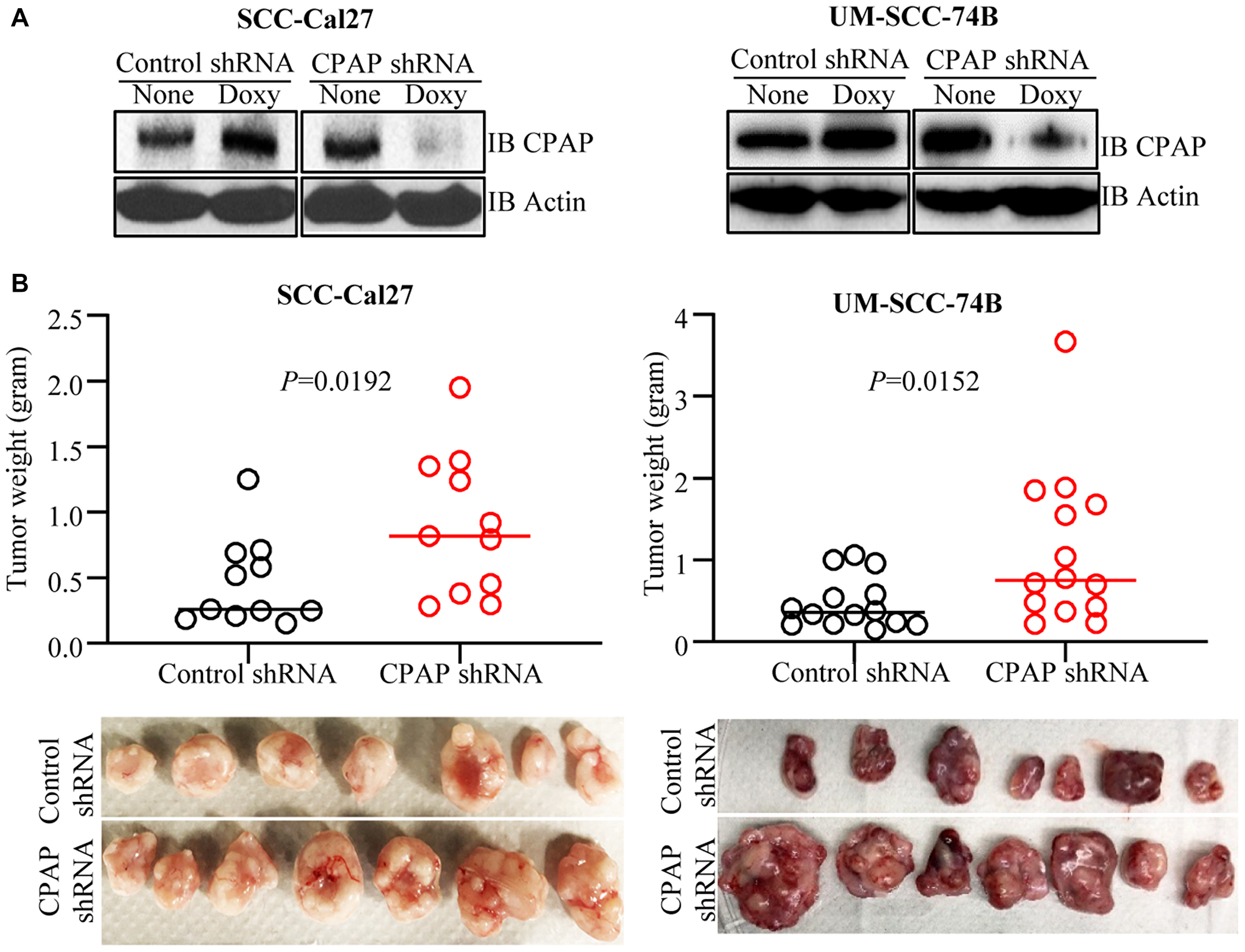 CPAP depletion enhances the tumorigenic properties of OSCC cell lines