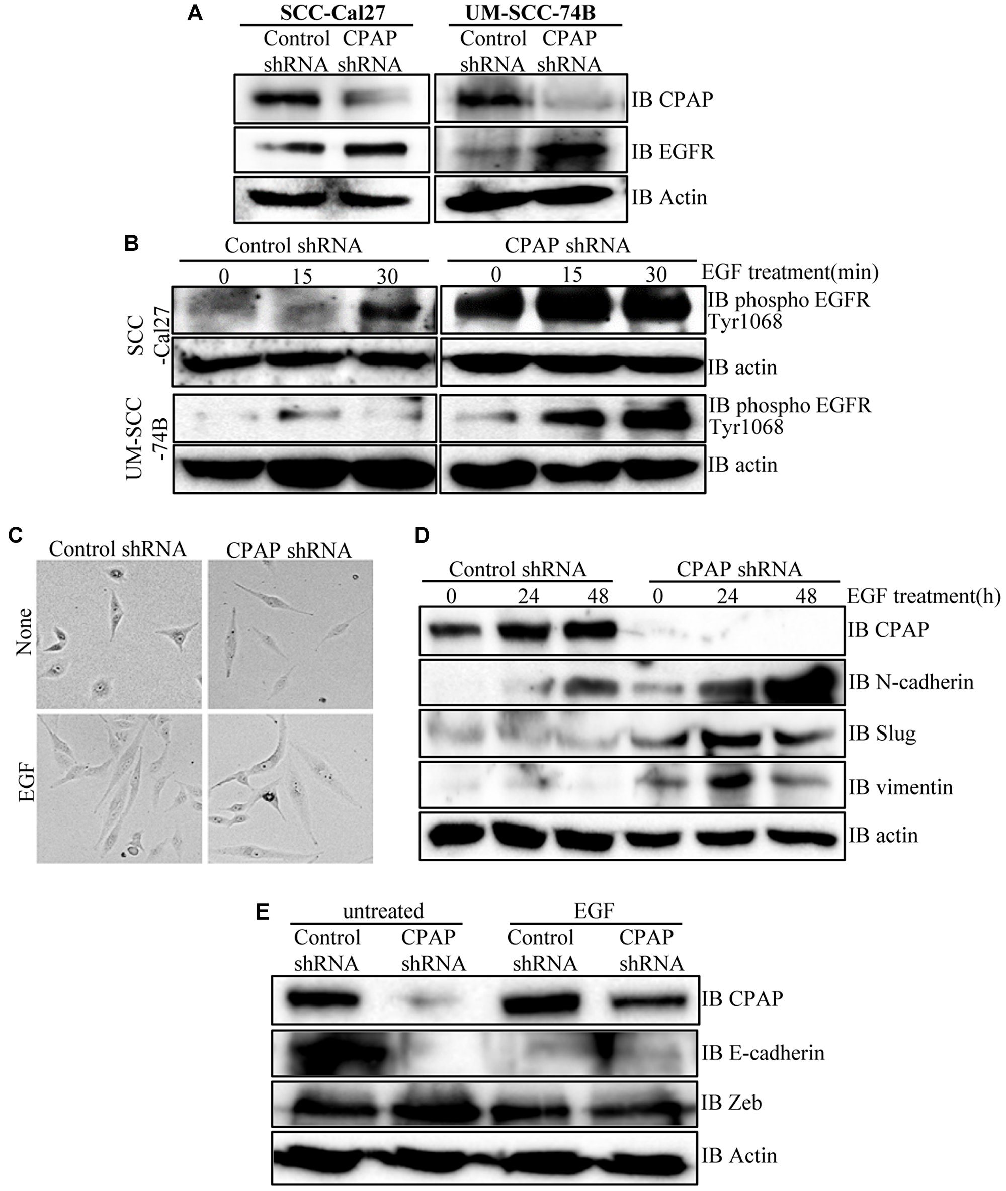 CPAP depletion in OSCC cells causes an increase in cellular levels of total and phospho-EGFR proteins, and EGF treatment enhances EMT-like features in these cells