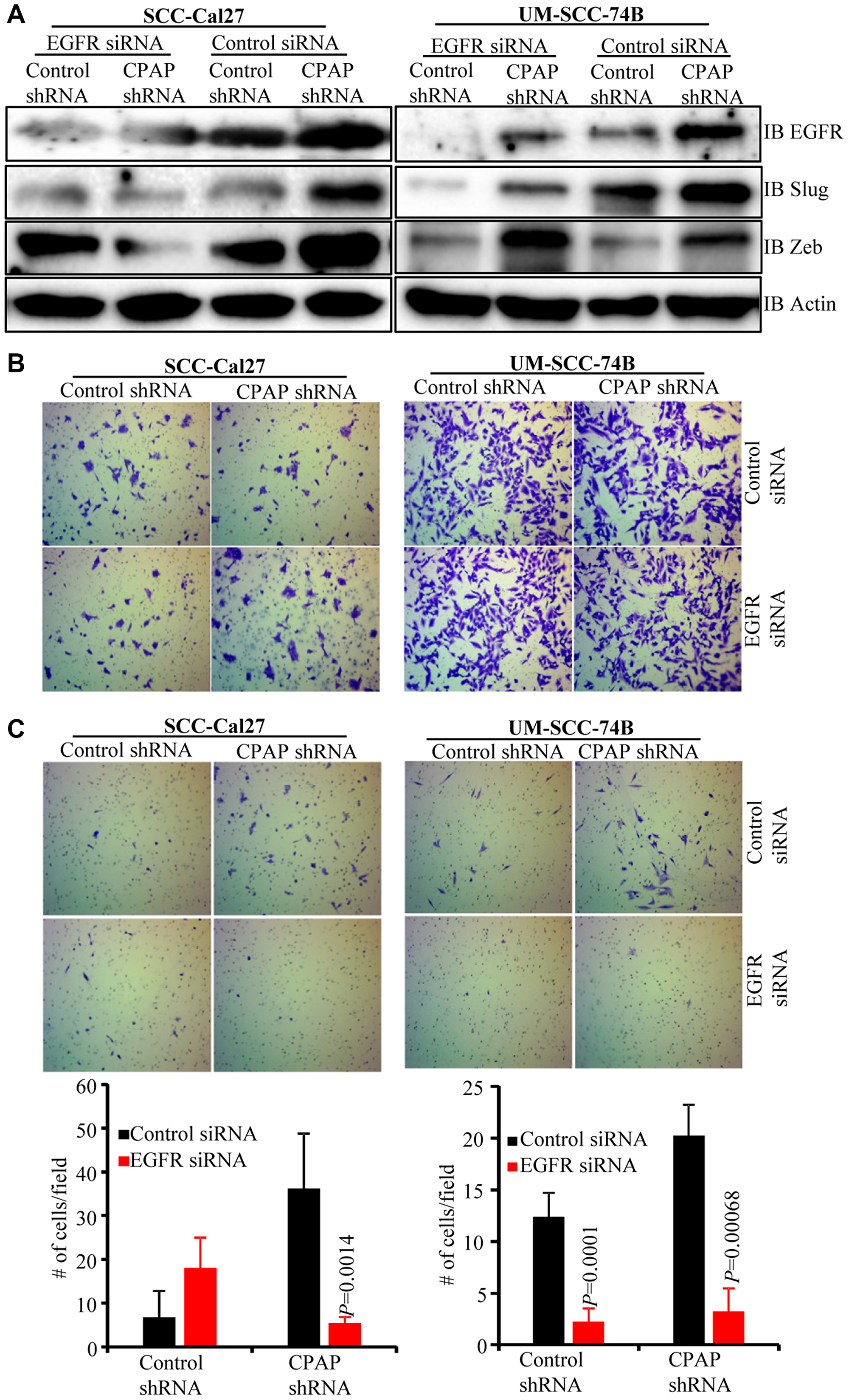 EGFR depletion diminishes the EMT phenotype and invasive property of CPAP-depleted OSCC cells
