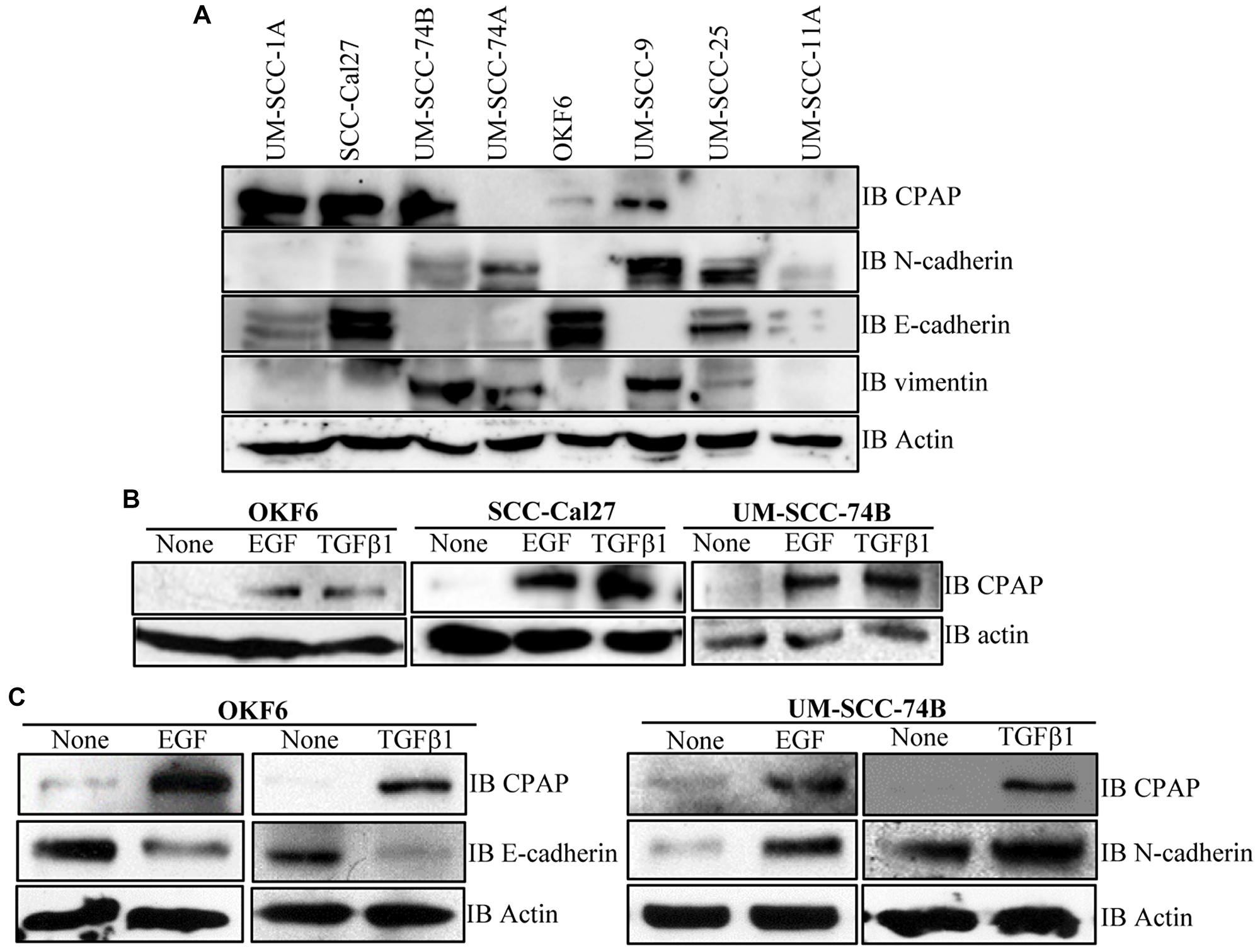CPAP and EMT marker levels in OSCC and normal cell-lines