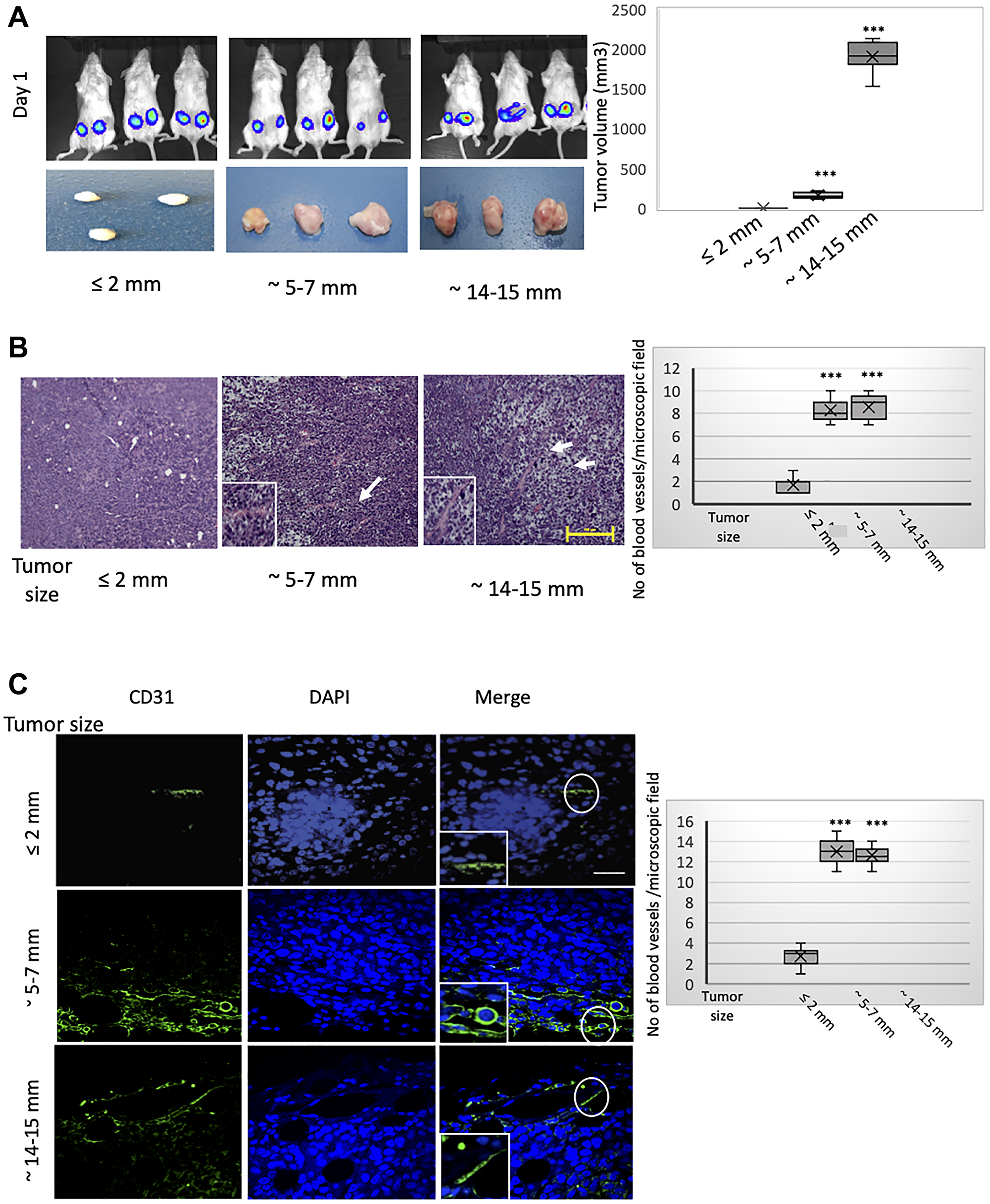 MCF-7 tumors of different sizes exhibit progressively developed vasculatures incorporating CD31-positive cells of human donor origin