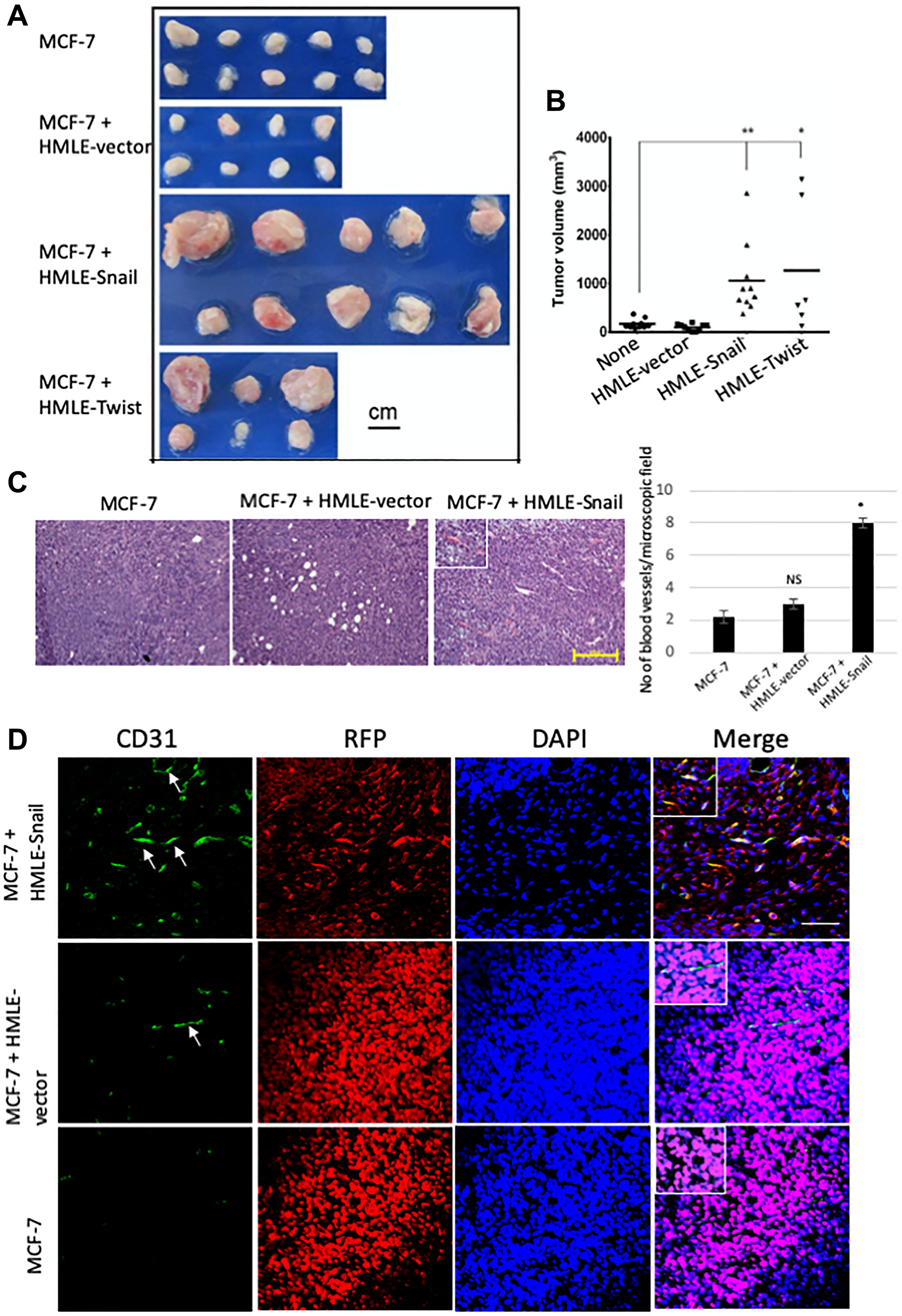 Cells that have undergone EMT promote endothelial transdifferentiation, neovascularization, and outgrowth of admixed MCF-7 cells