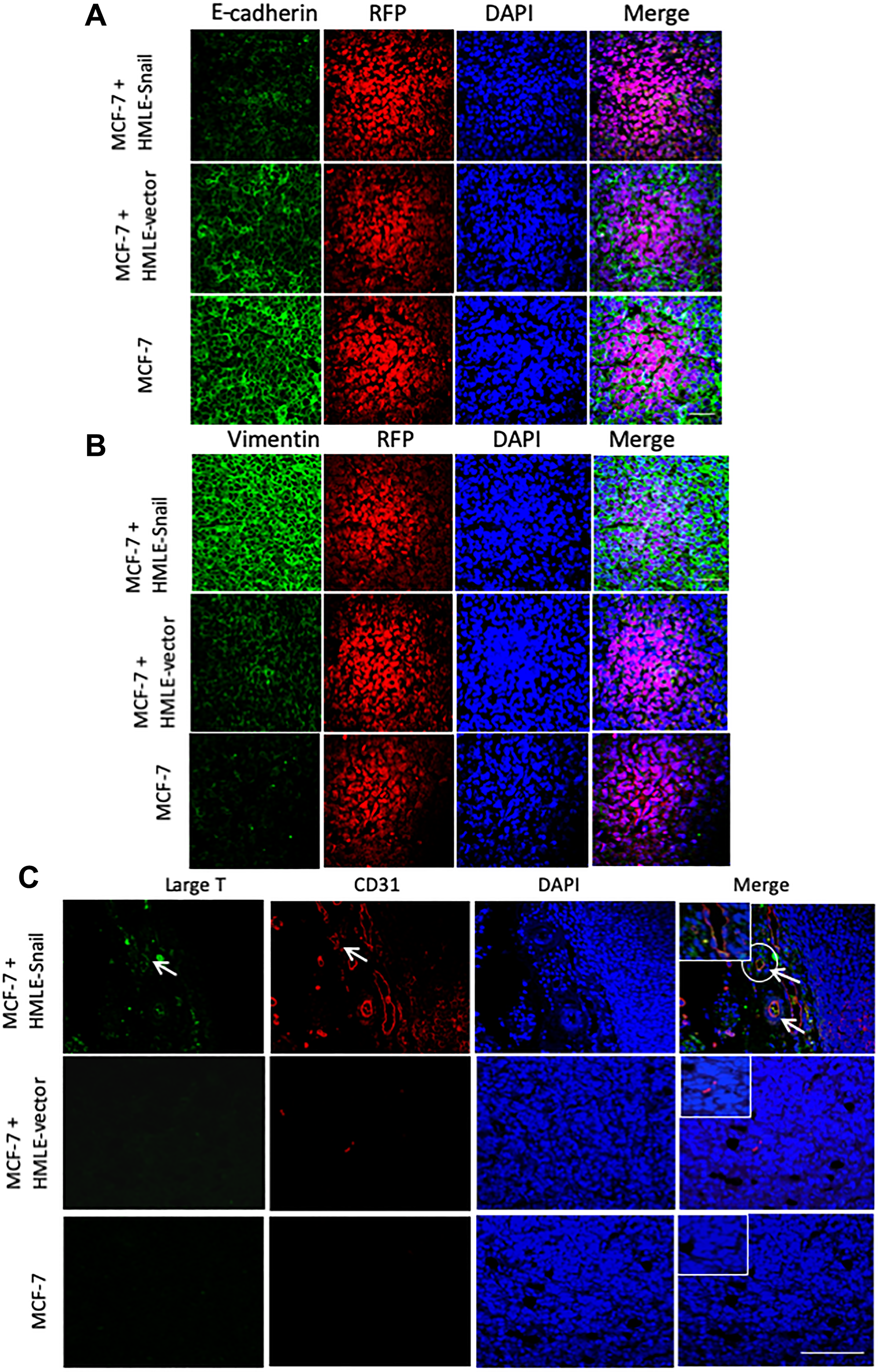 HMLE-Snail cells gain CD31 expression and promote acquisition of mesenchymal traits by admixed MCF-7 cells