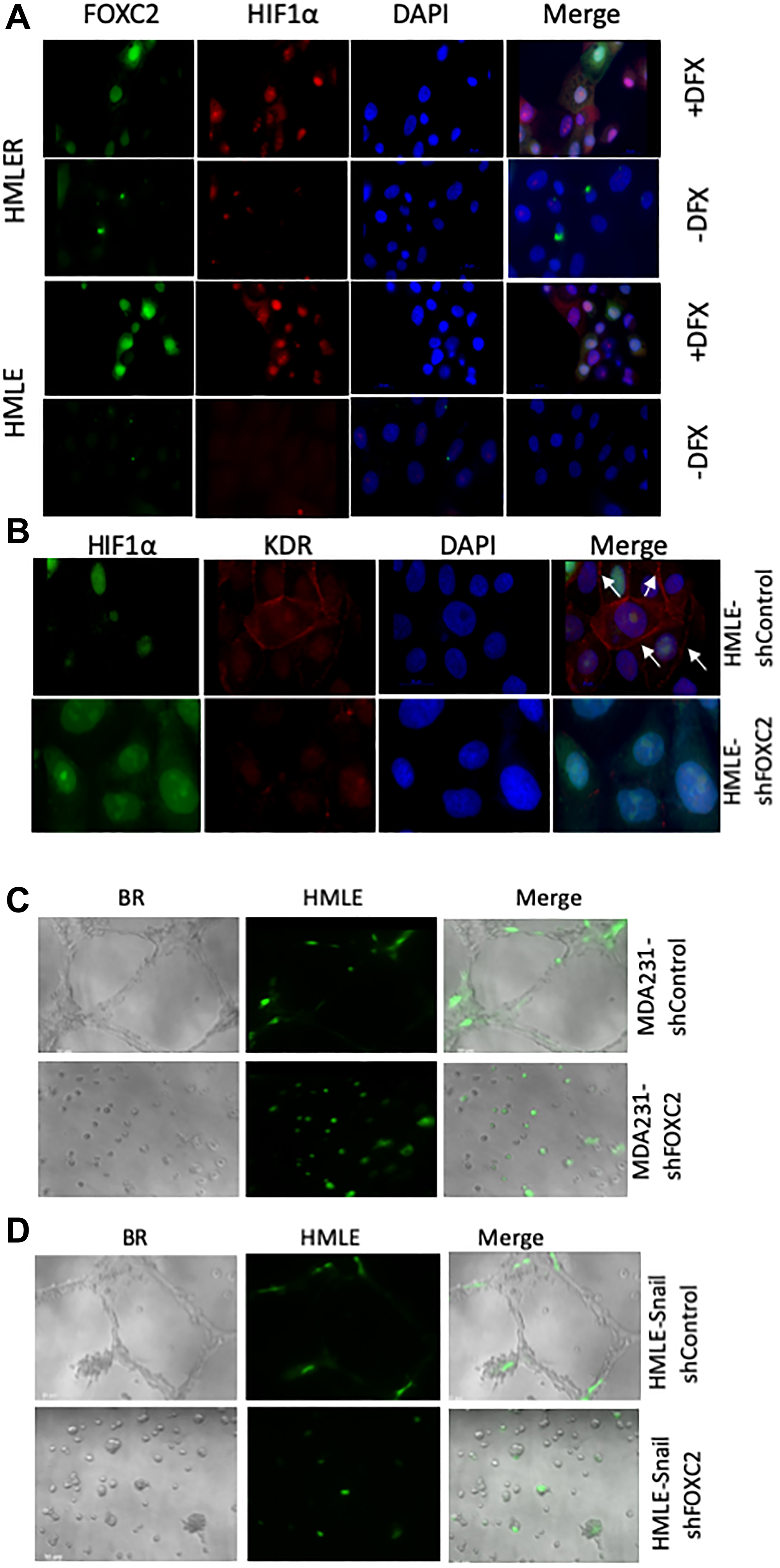 FOXC2 is necessary for the acquisition of endothelial phenotypic and functional characteristics in vitro