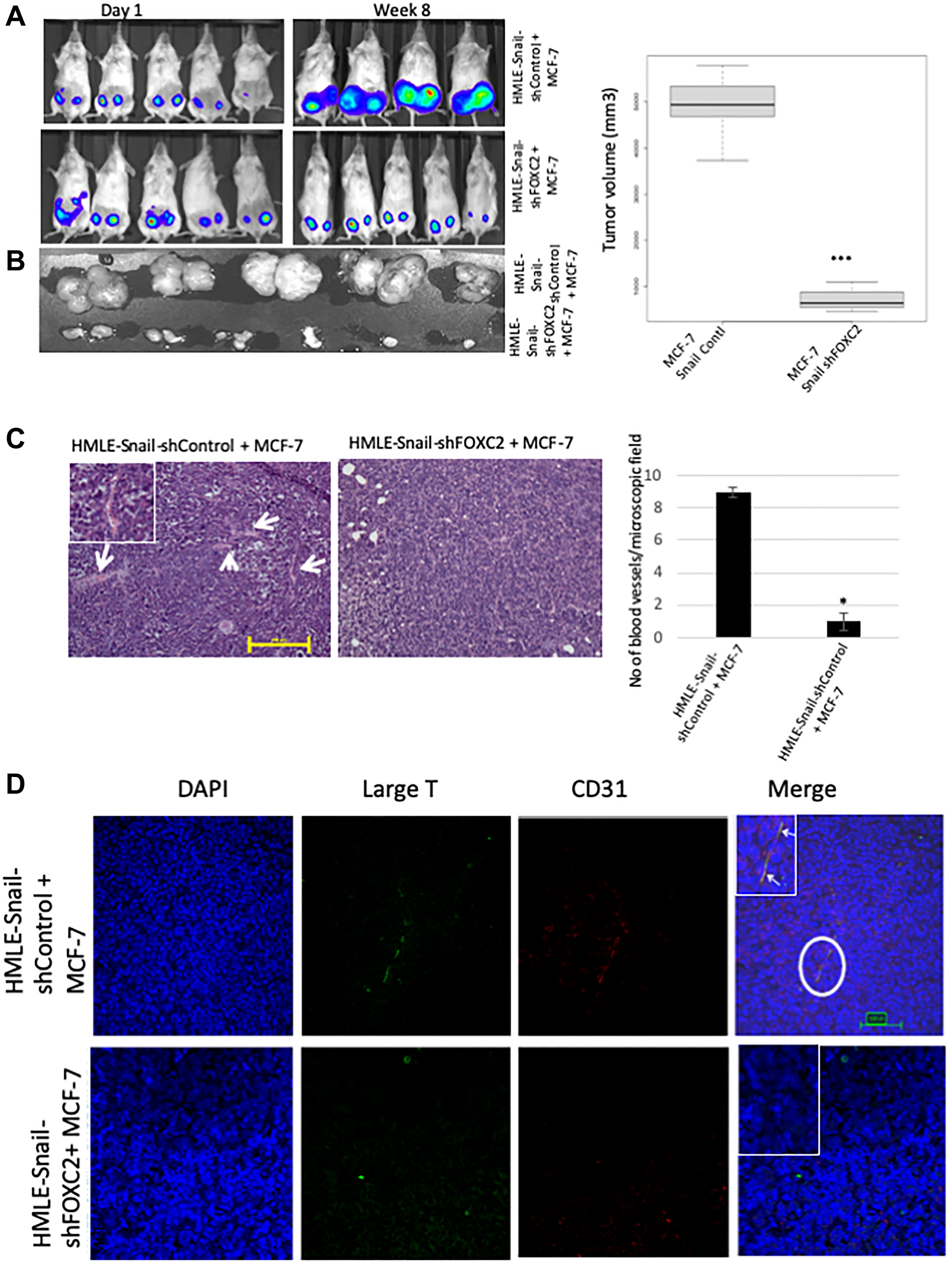 FOXC2 is necessary for the ability of cells that have undergone EMT to augment neoangiogenesis