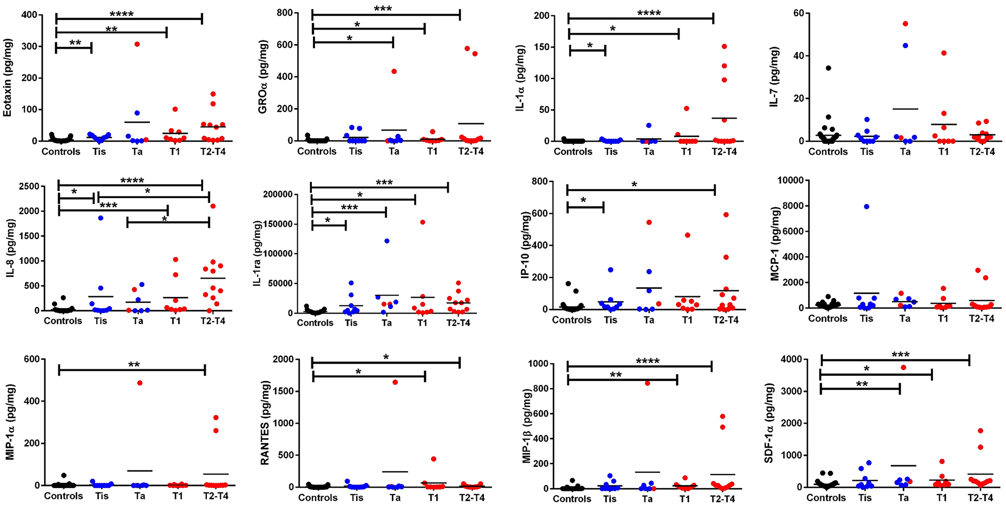 Luminex based screen of 16 urine proteins in bladder cancer