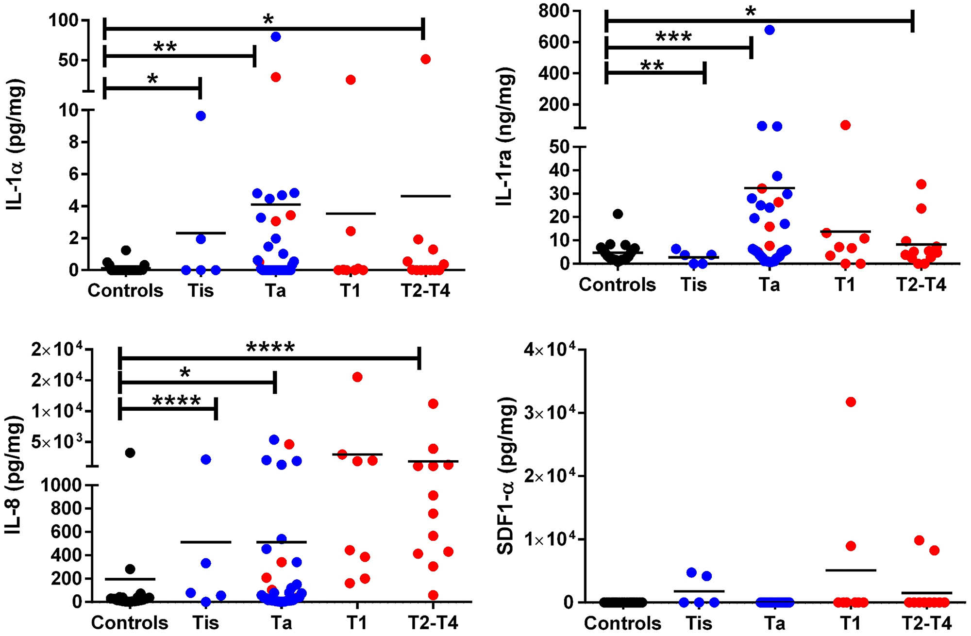 ELISA validation of IL-1α, IL-1ra, IL-8, and SDF-1α in bladder cancer patients with varying clinical stages
