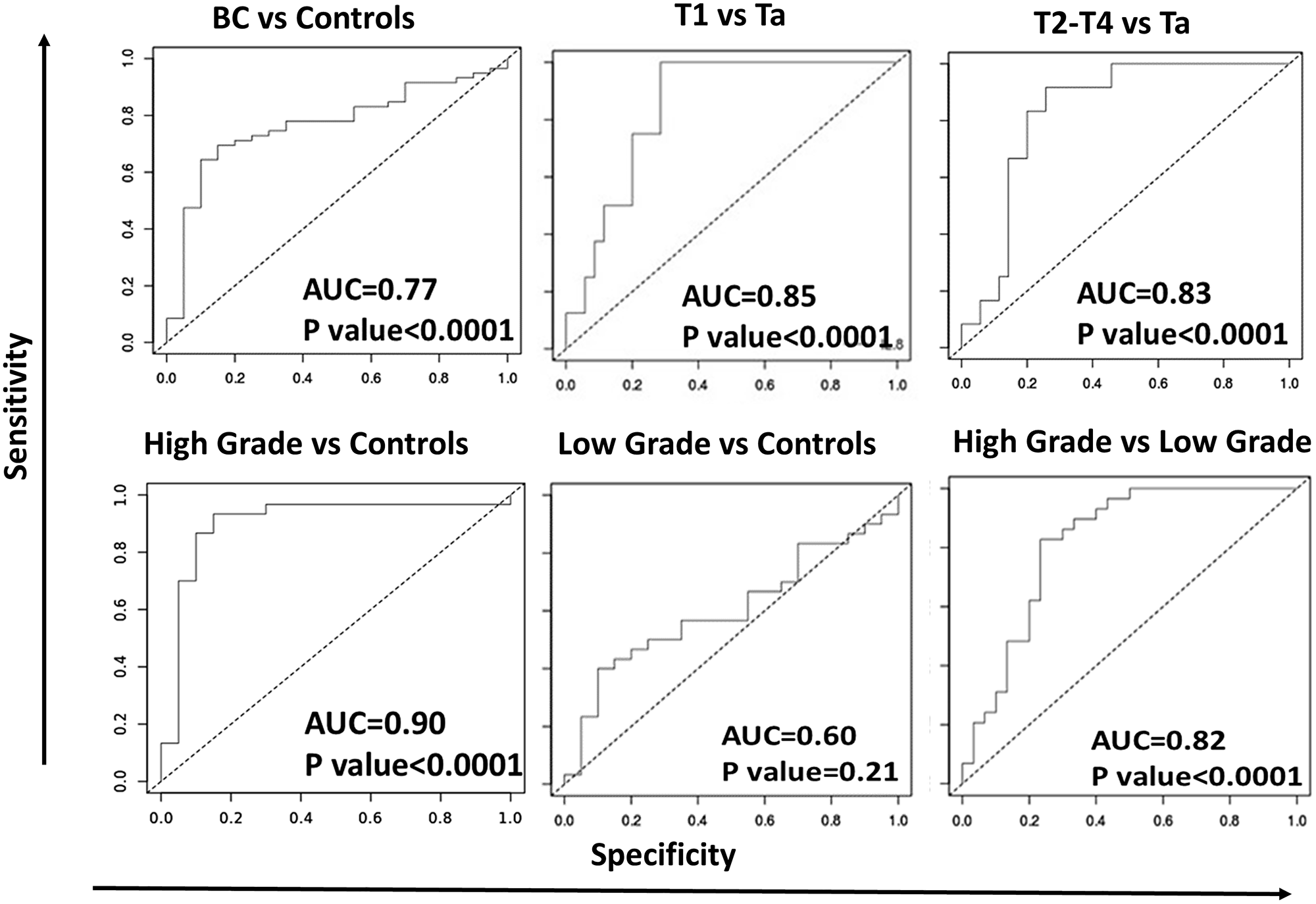 ROC-AUC curves for urine IL-8 in distinguishing different stages of bladder cancer