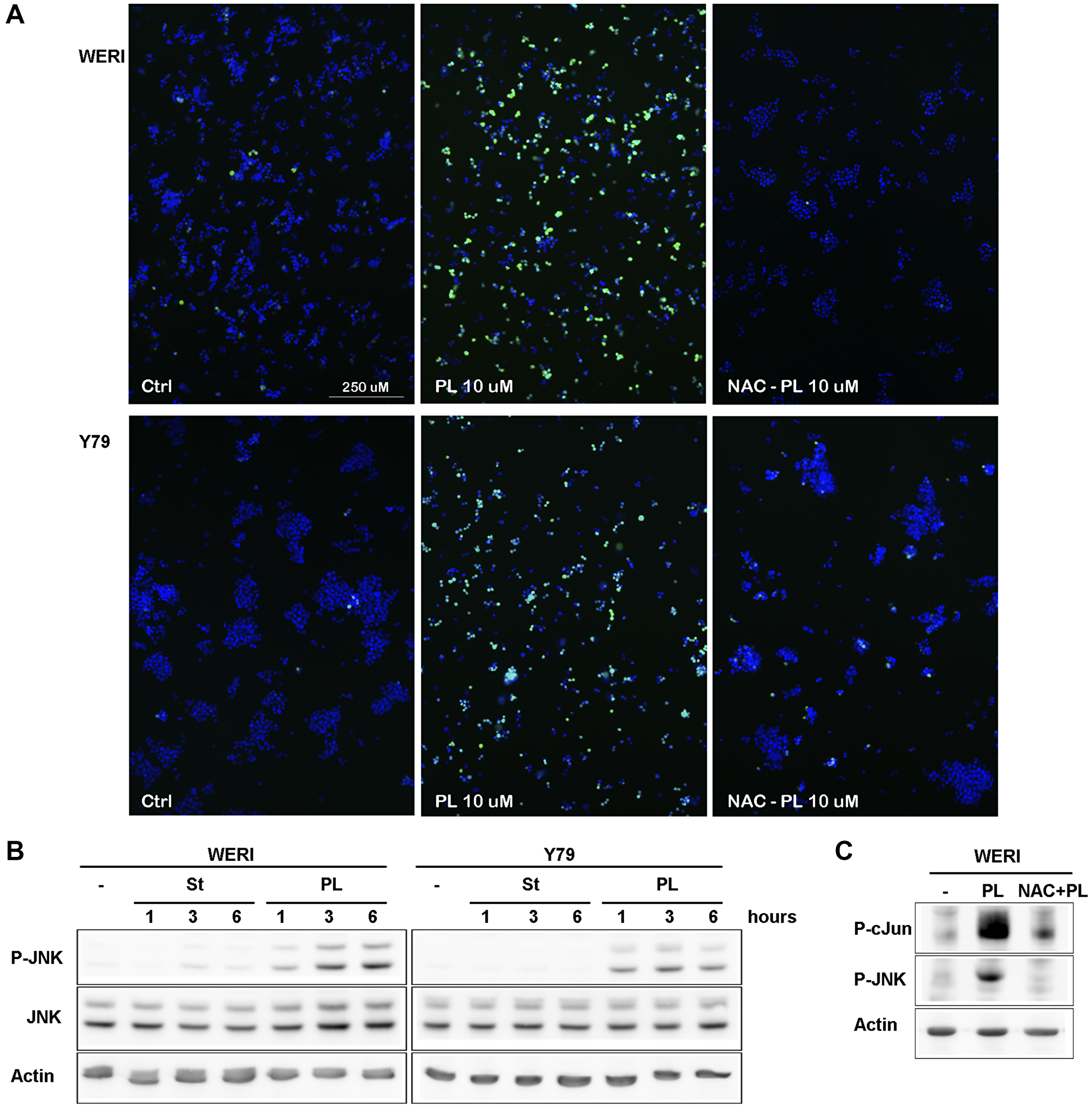 PL induces ROS production in WERI-Rb and Y79 followed by JNK activation
