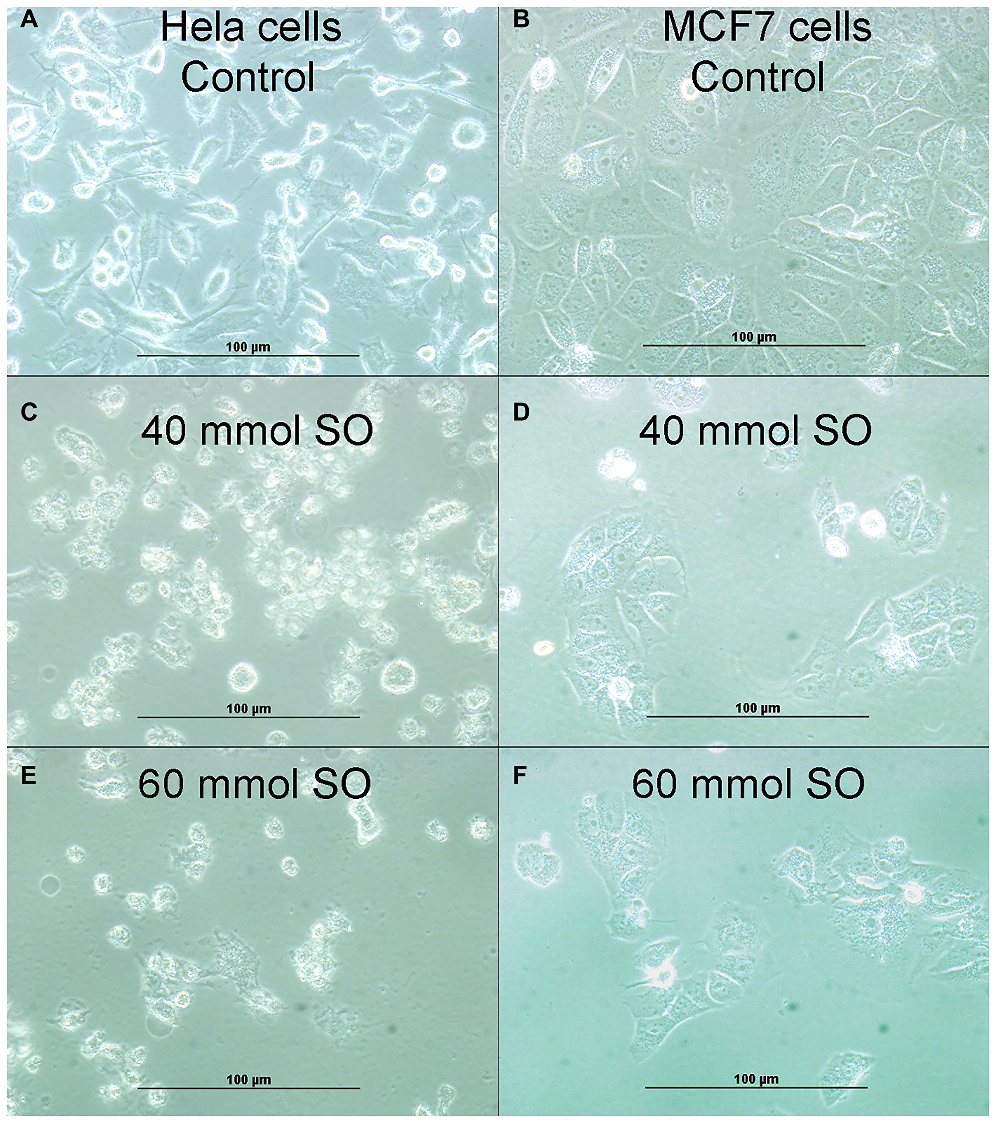 (A) Showing cellular growth of untreated HeLa cells. (B) Showing cellular growth of untreated MCF-7 cells. (C) Showing reduction of cellular proliferation in 40 mmol-treated HeLa cells. (D) Showing reduction of cellular proliferation in 40 mmol-treated MCF-7 cells. (E) Showing more reduction of cellular proliferation in 60 mmol-treated HeLa cells. (F). Showing more reduction of cellular proliferation in 60 mmol-treated MCF-7 cells.