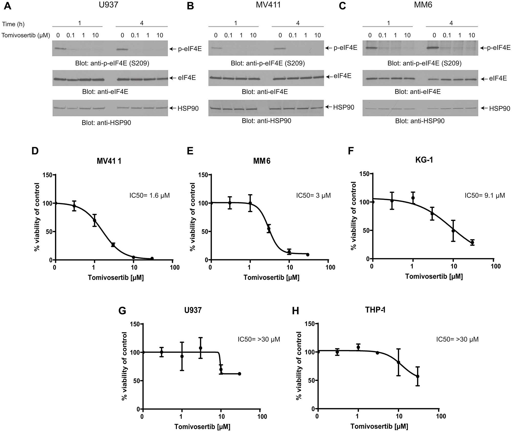 Tomivosertib blocks phosphorylation of eIF4E at Ser209 and inhibits cell viability in AML cells
